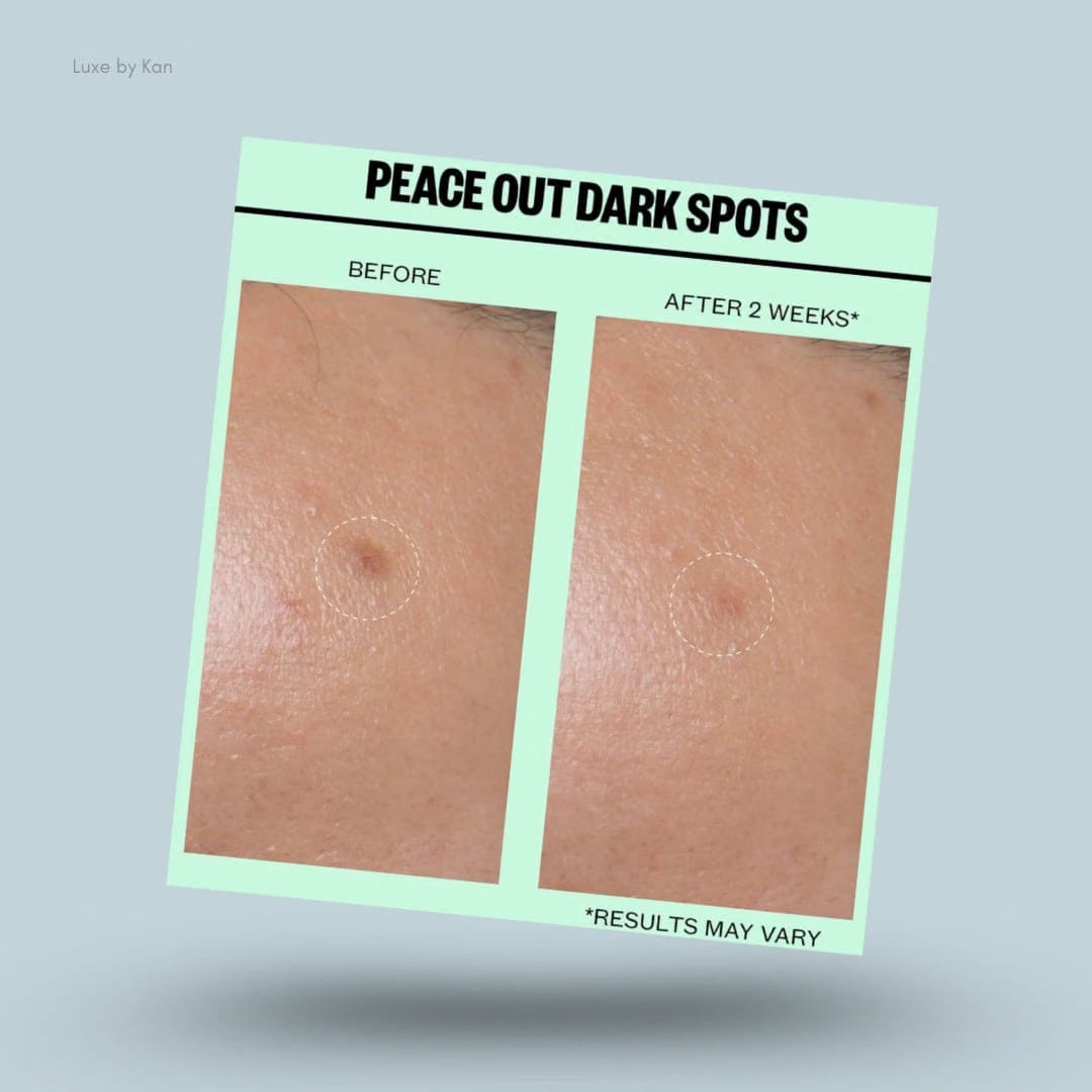 Peace Out Dark Spots