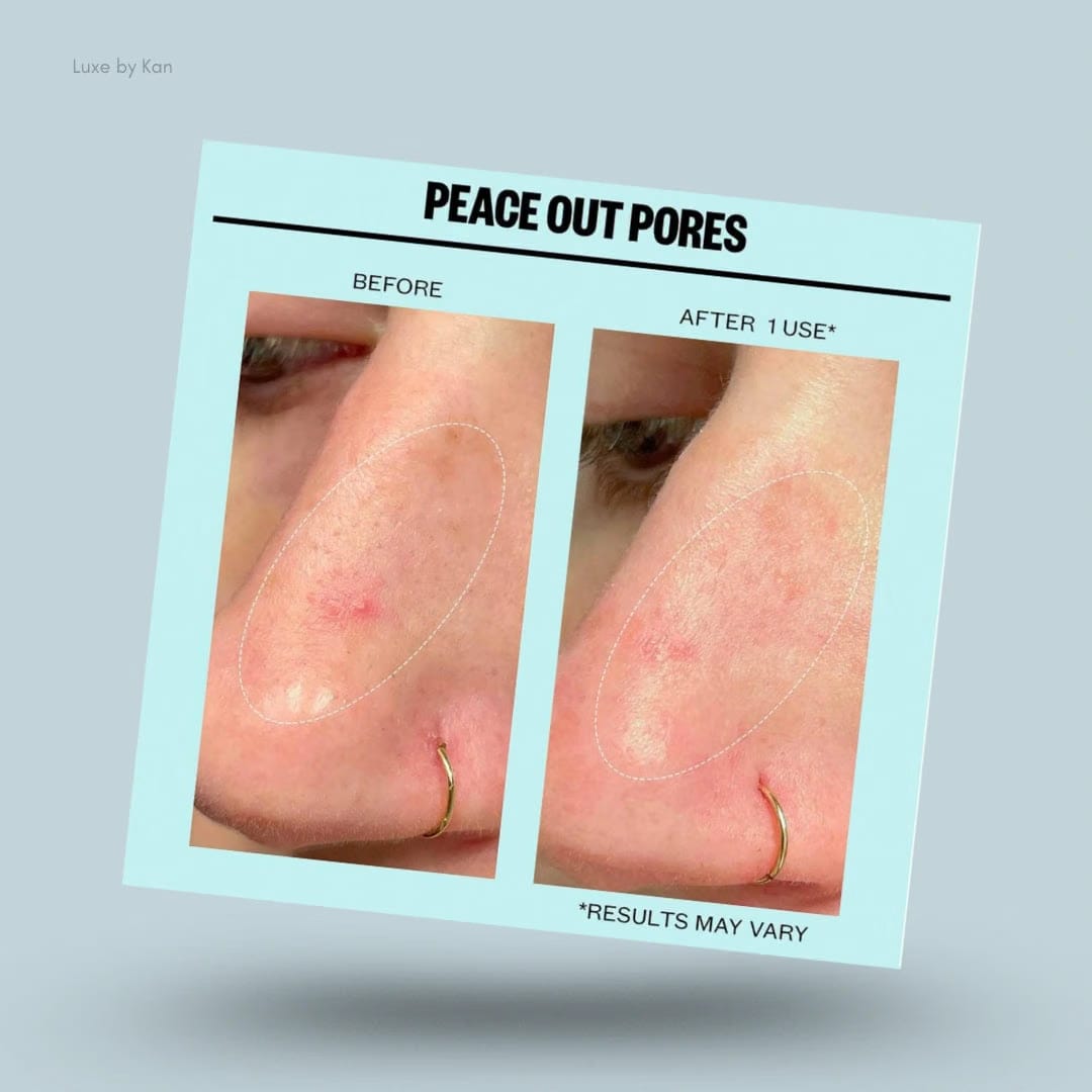 Peace Out Dark Spots