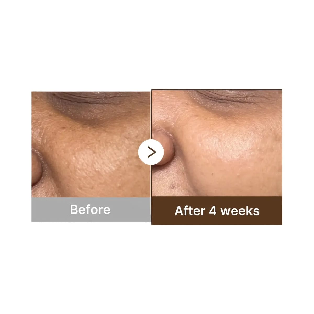 Medicube Deep Vitamin C Capsule Serum