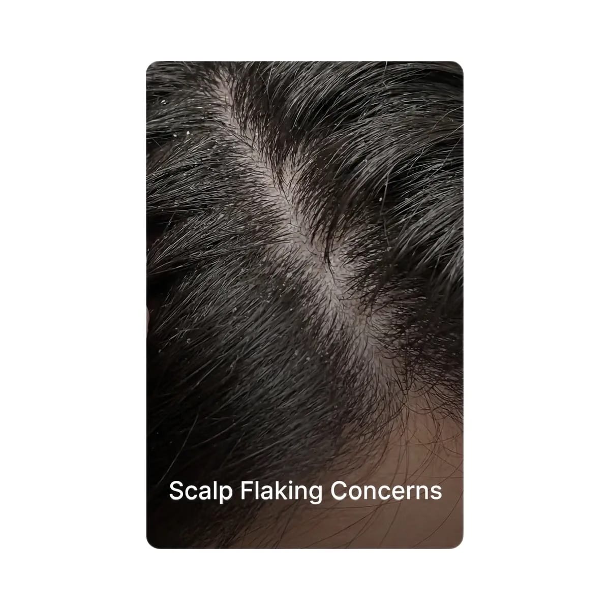 Medicube Rosemary PDRN Scalp Serum