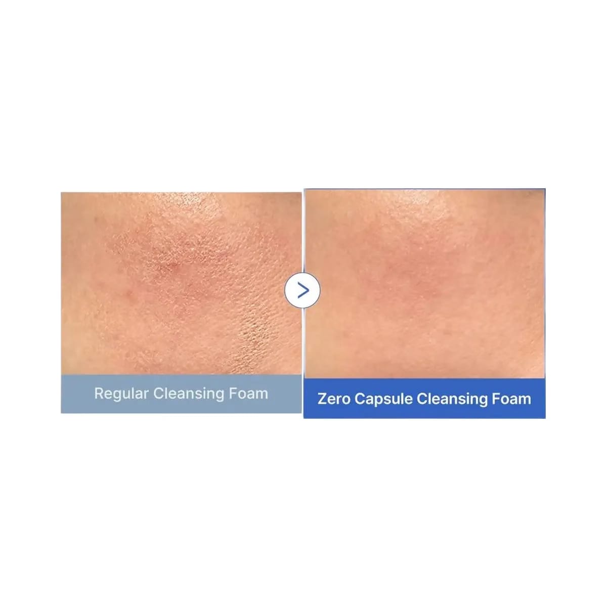 medicube Zero Pore SA Clear Capsule Facial Deep Cleanser