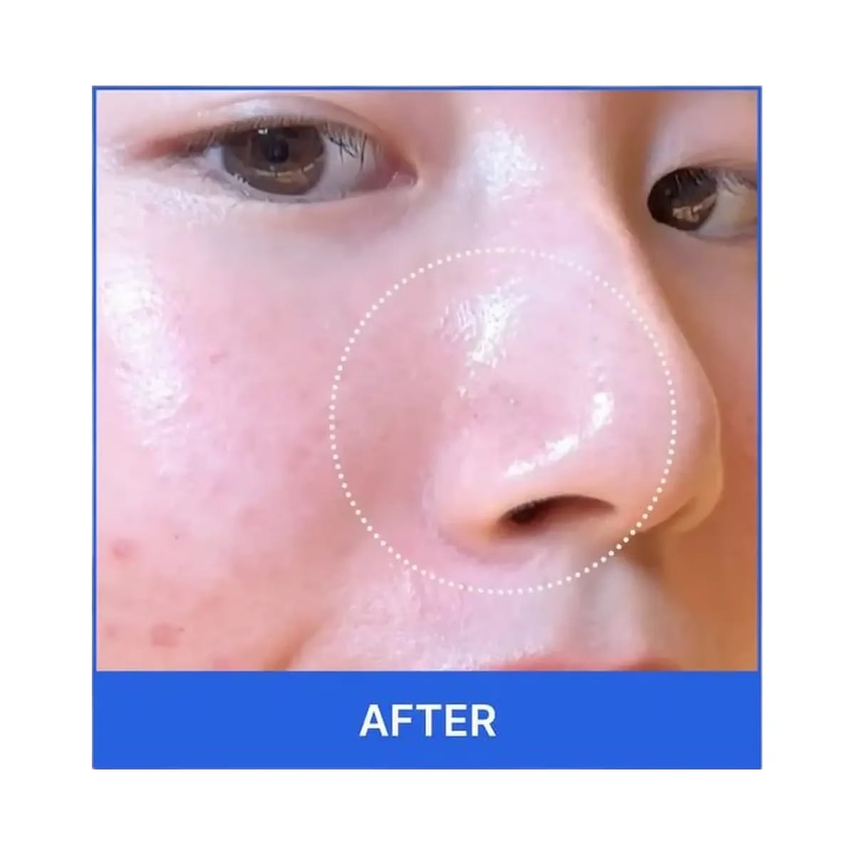 medicube Zero Pore Pad