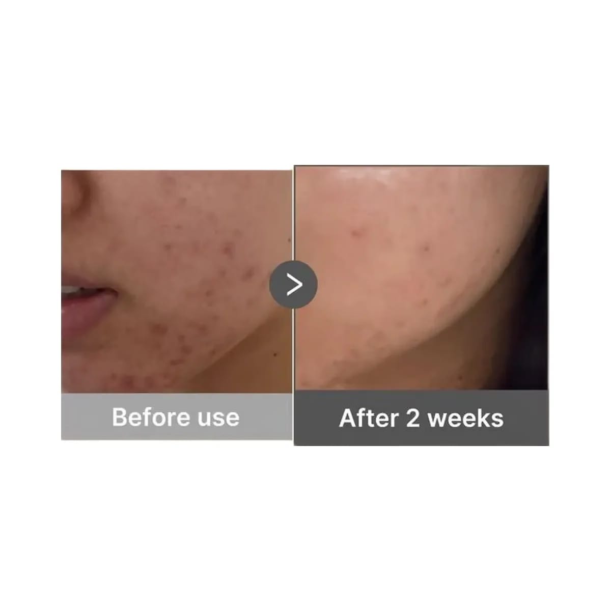 medicube Kojic Acid Turmeric Niacinamide Serum