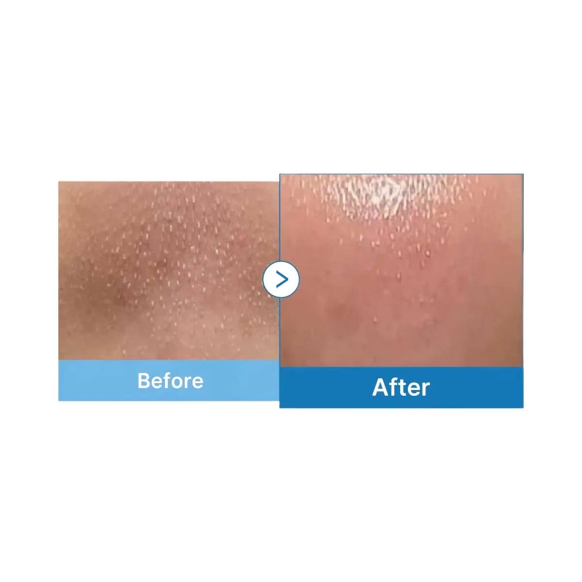Medicube Zero Pore Blackhead Deep Cleansing Oil