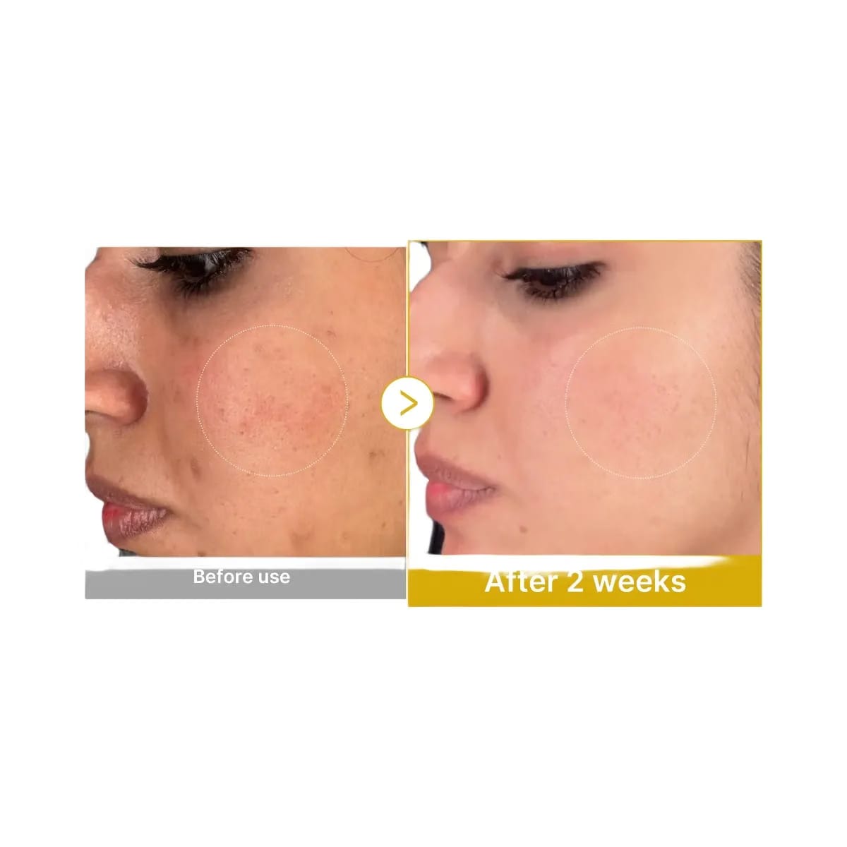 Medicube Kojic Acid Turmeric Toner