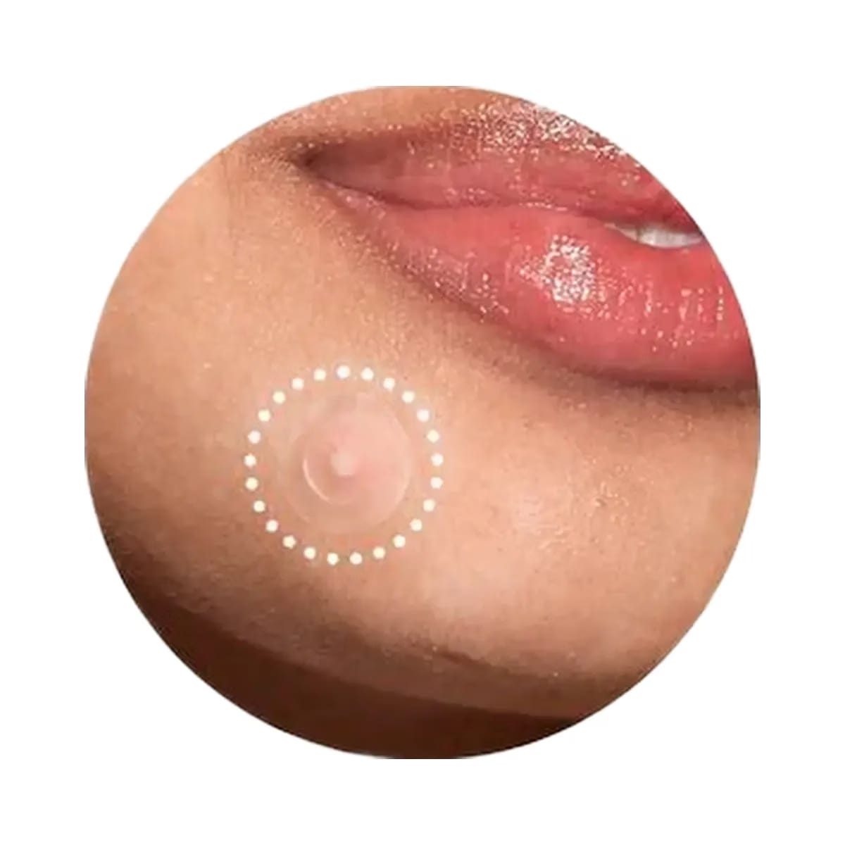 Rael Miracle Patch Invisible Spot Cover