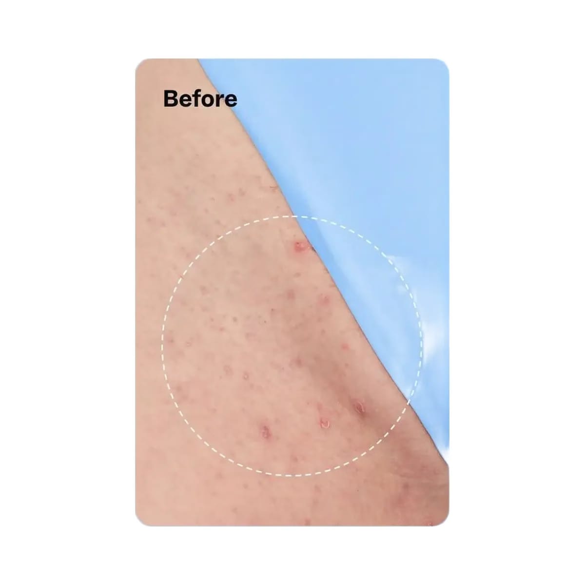 Peach Slices Smoothing Solution Ingrown Hair Treatment