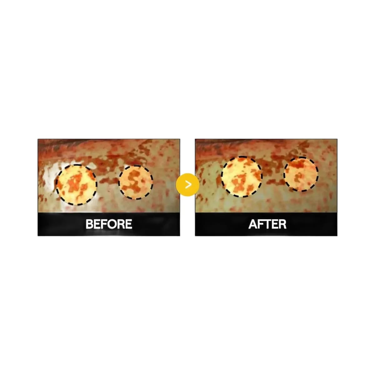 MEDIHEAL Vita Collagen Eye Ampoule Patch
