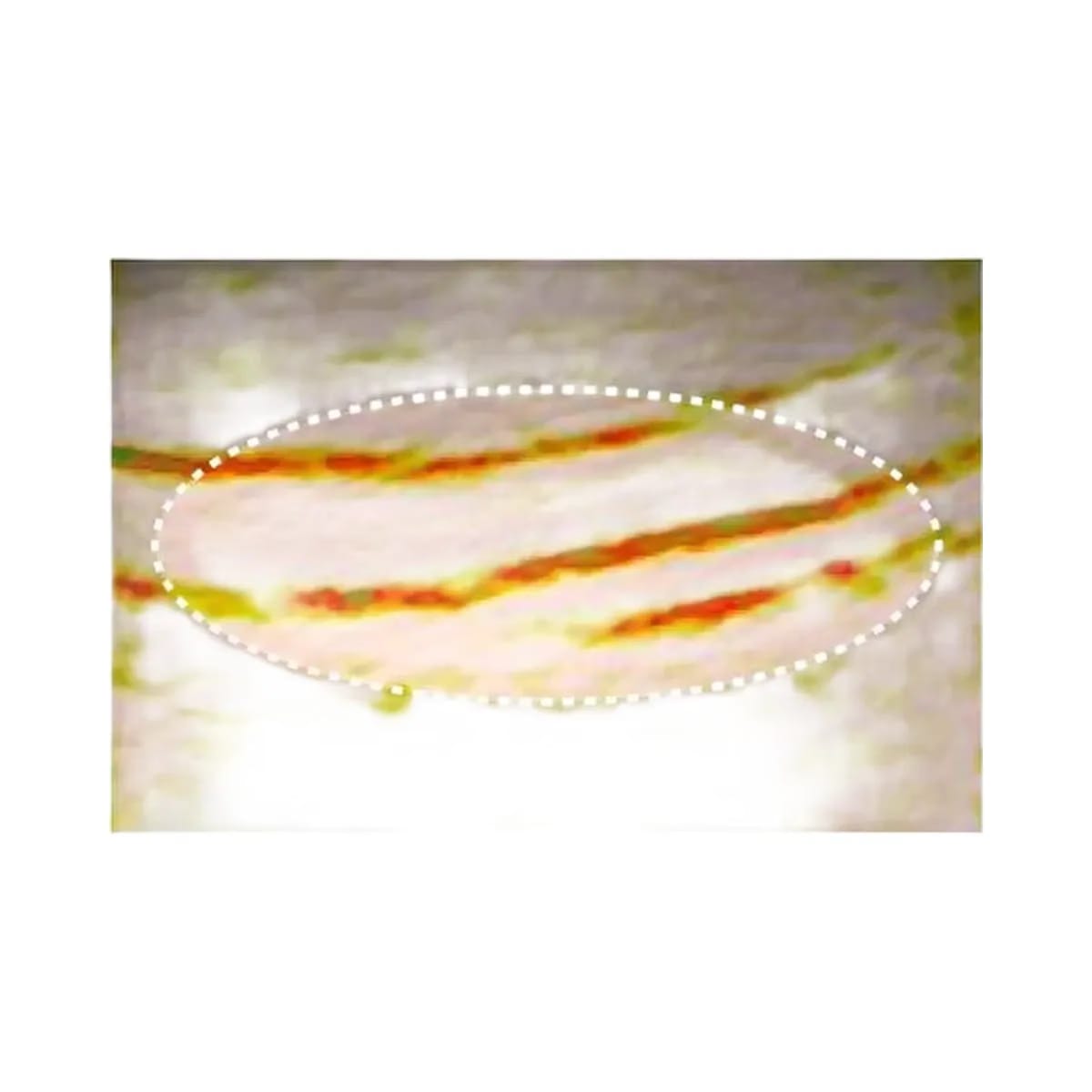 ANUA PDRN Collagen Melting Patch For Neck