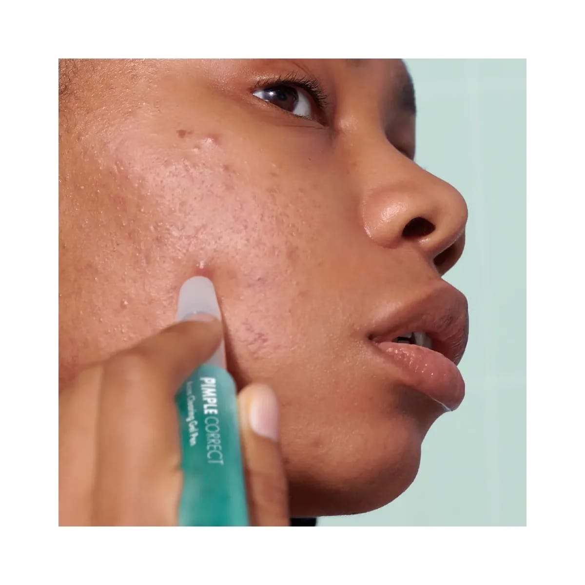 Hero Cosmetics Pimple Correct Acne Clearing Gel Pen