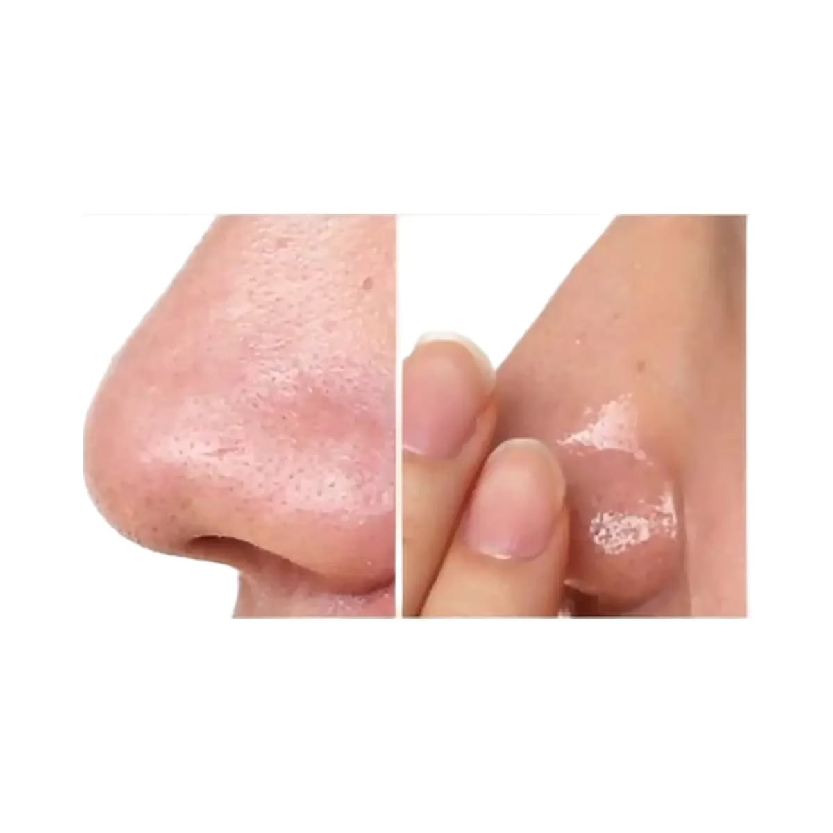 Hanskin Pore Cleansing Balm - AHA
