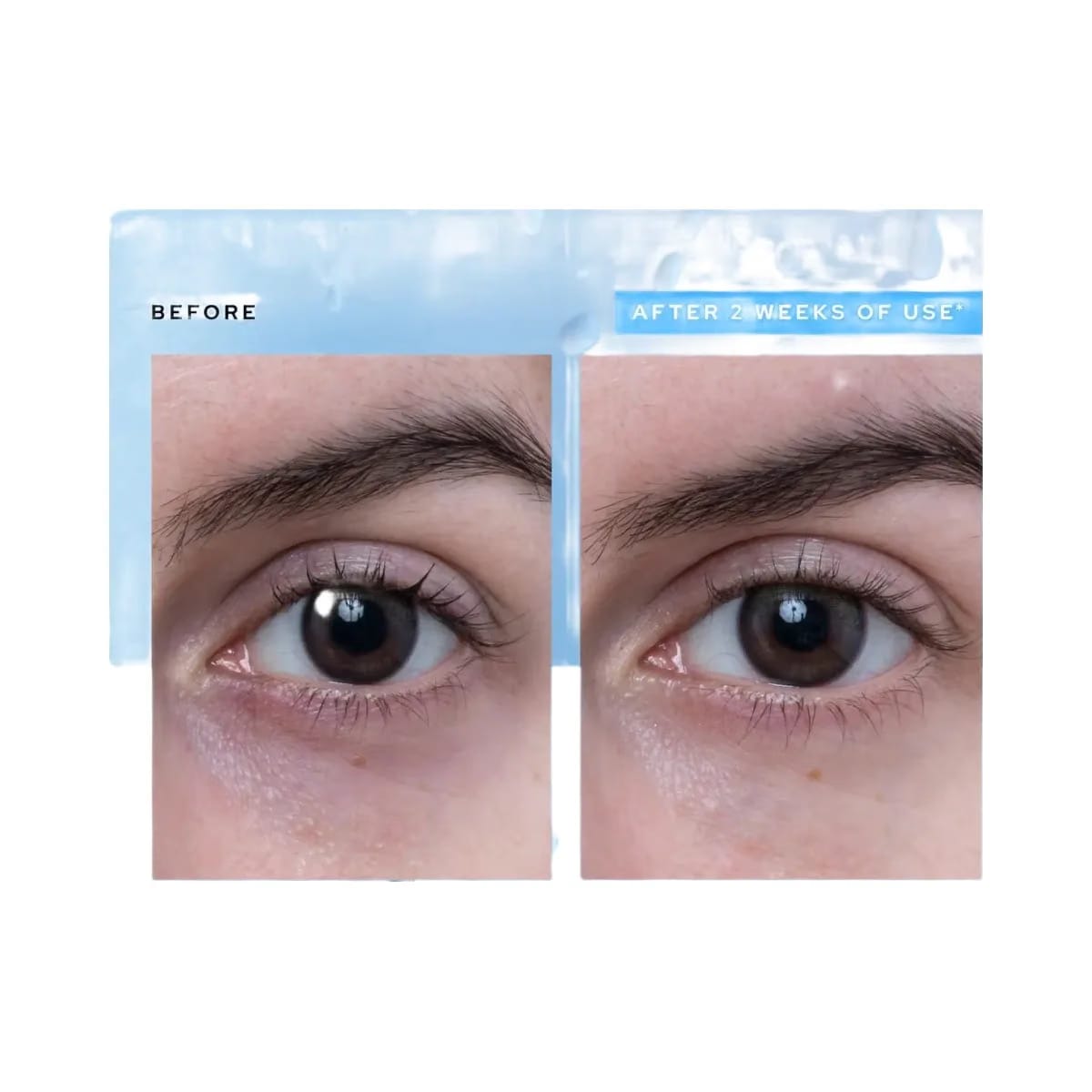 belif Aqua Bomb Depuffing Eye Gel with Caffeine + Hyaluronic Acid