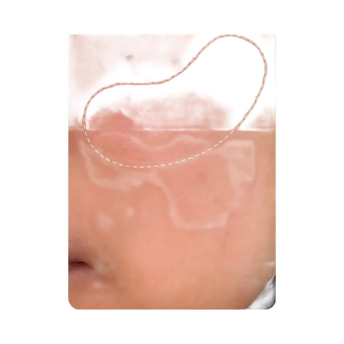 Peach Slices Super Fade Discoloration Serum