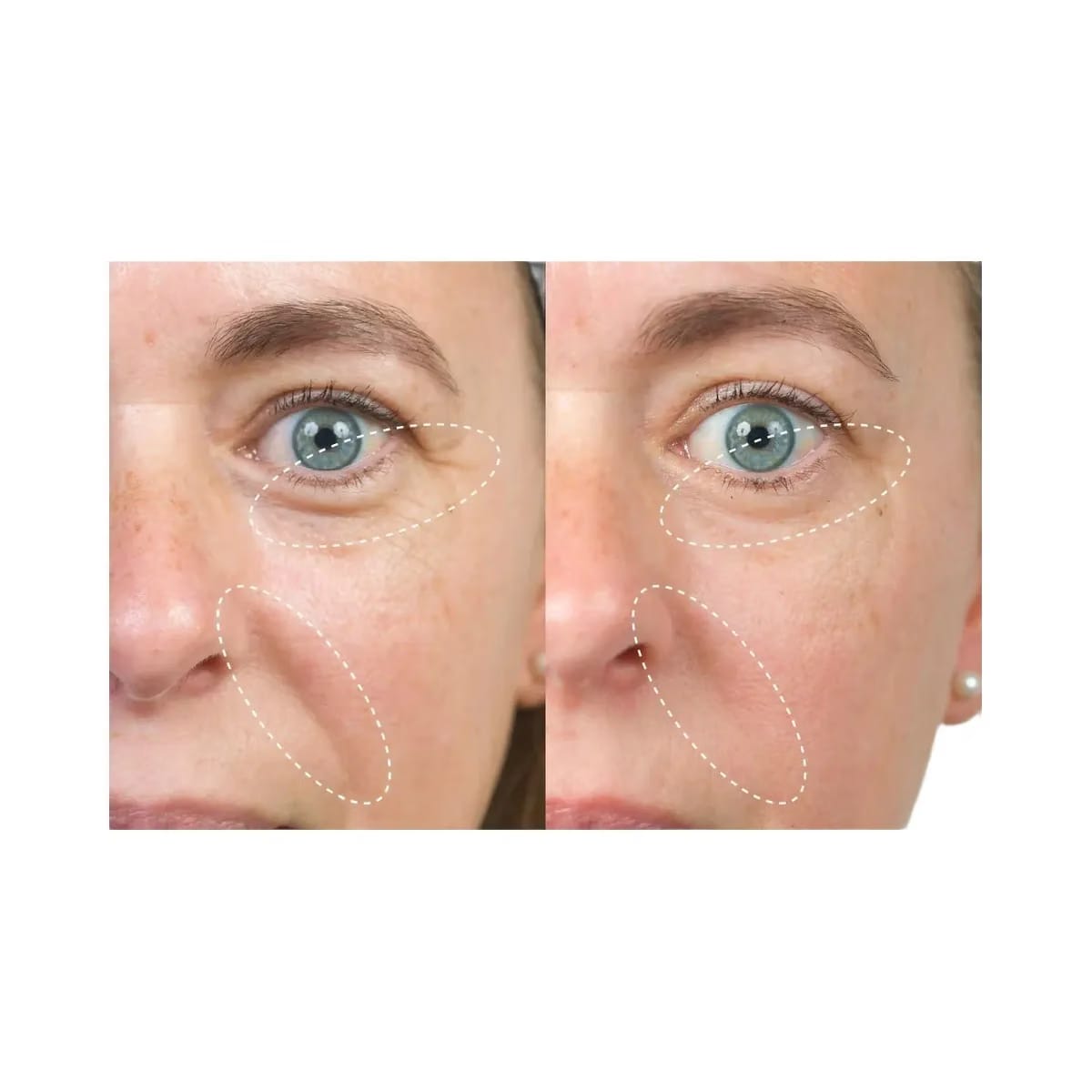 INKEY Bio-Active Ceramide Repairing and Plumping Moisturizer