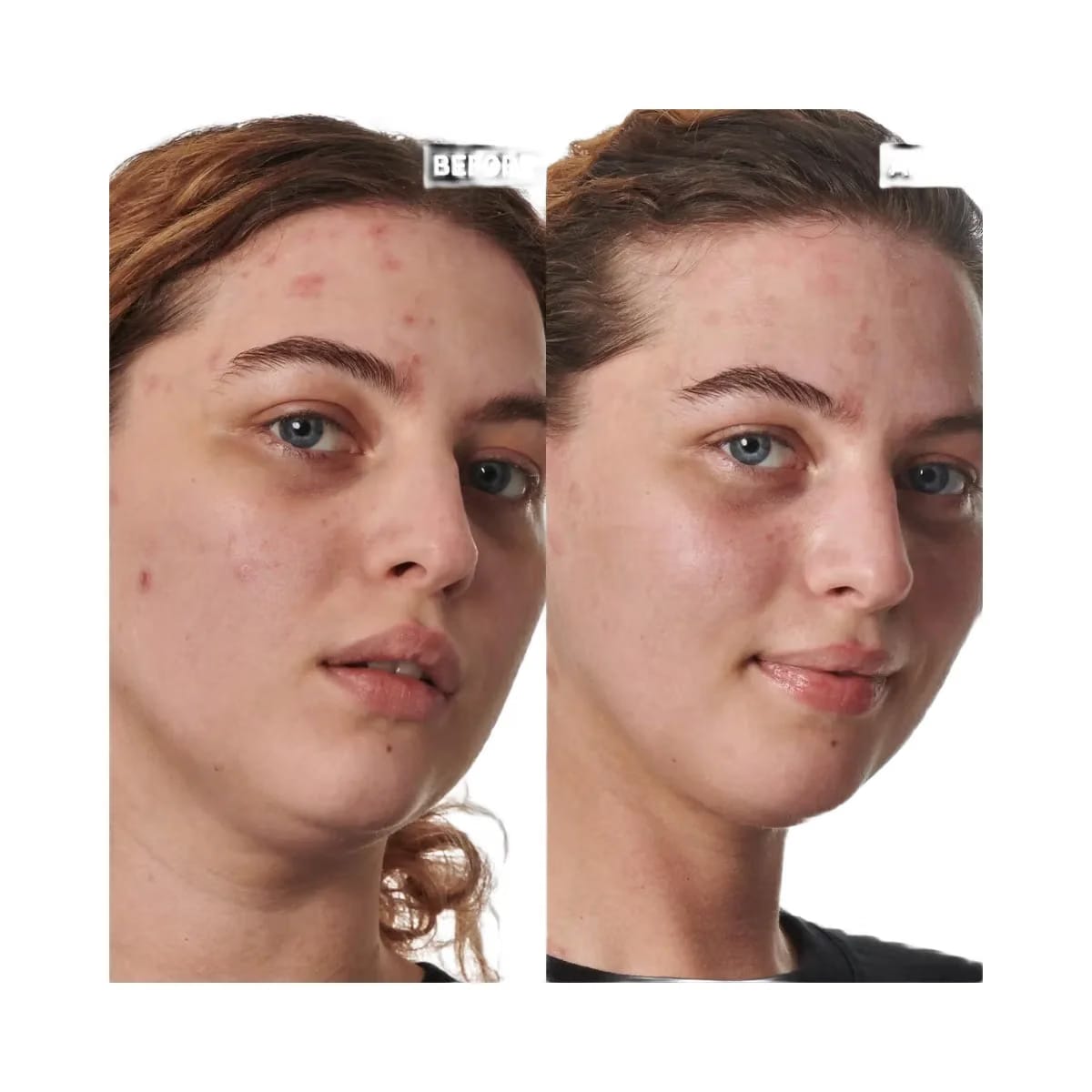 INKEY SuperSolutions 10% Urea Moisturizer Textured Skin Solution