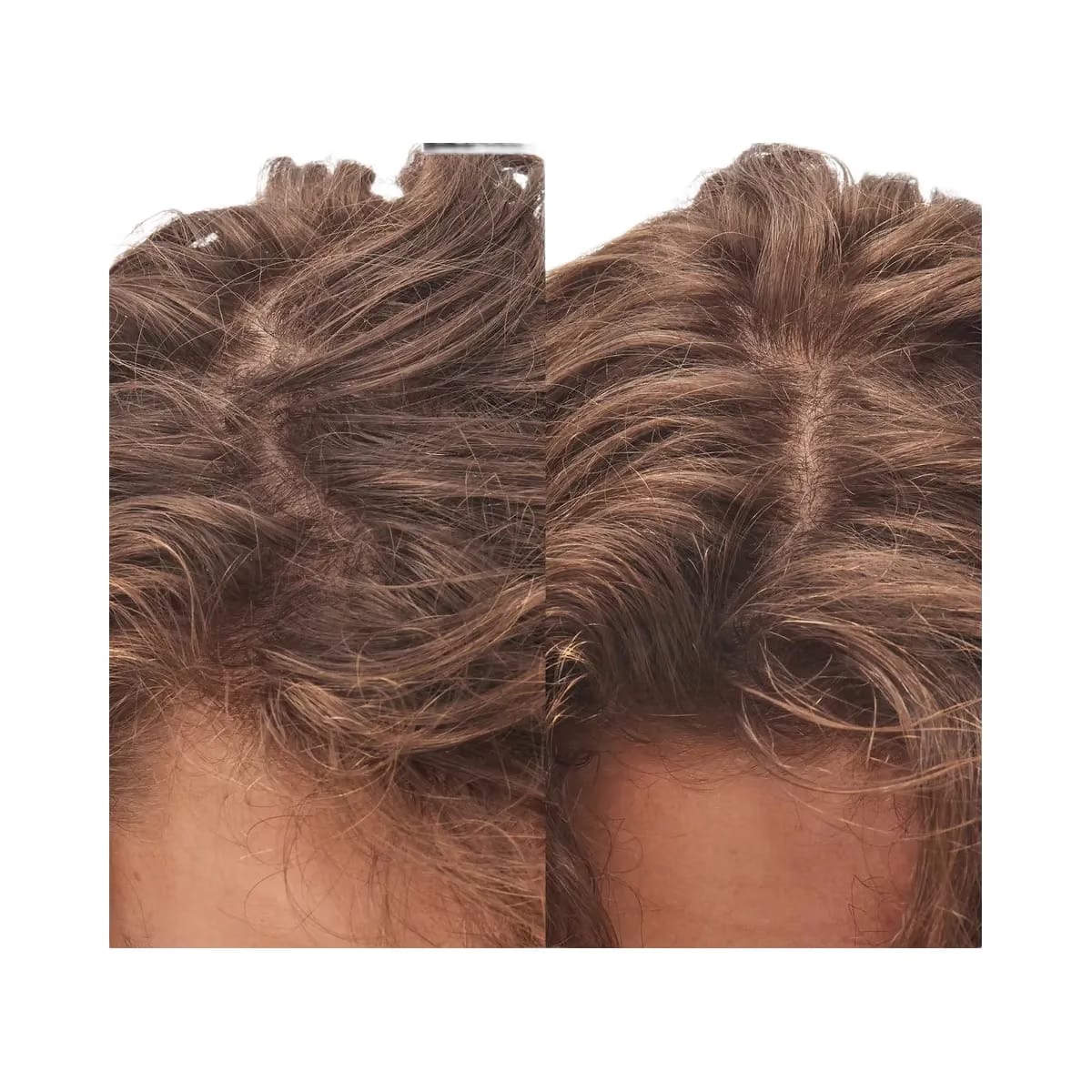 INKEY Glycolic Acid Exfoliating Scalp Scrub