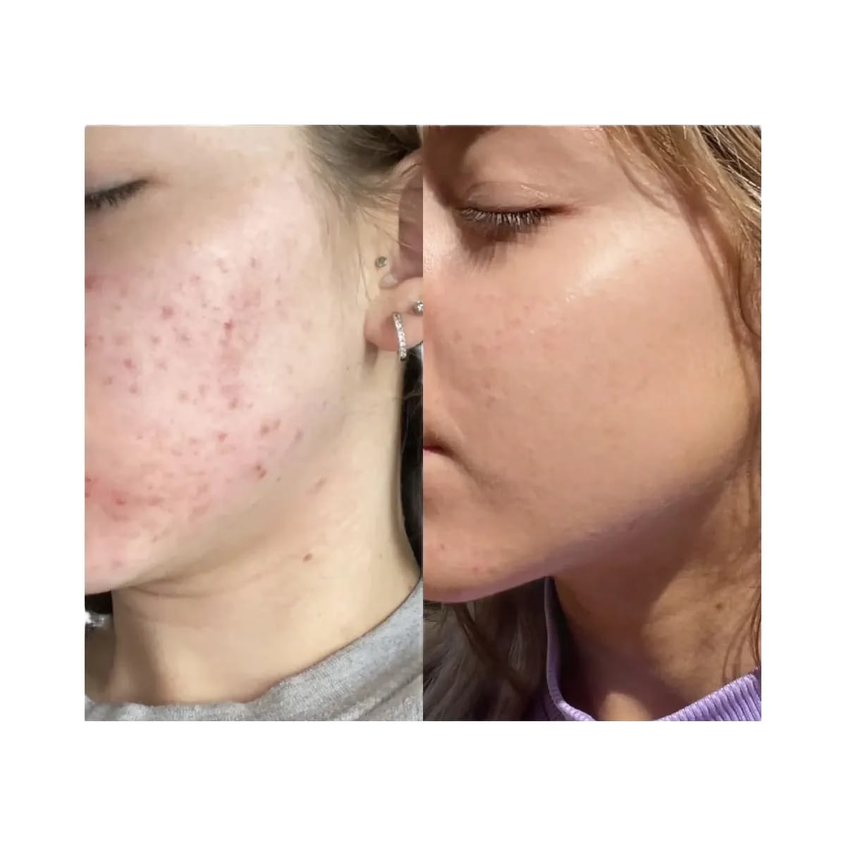 INKEY Niacinamide Oil Control Serum