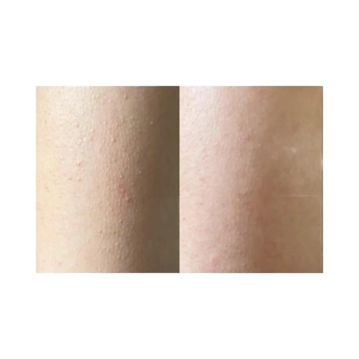 INKEY Glycolic Acid Exfoliating Body Stick