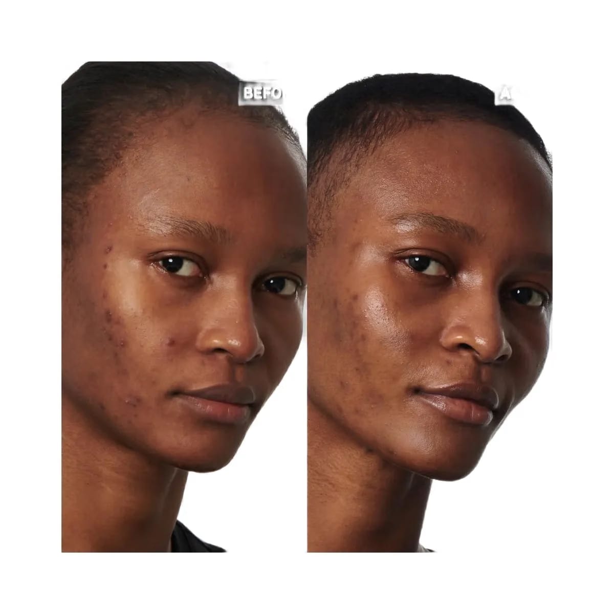 INKEY SuperSolutions 20% Niacinamide Serum