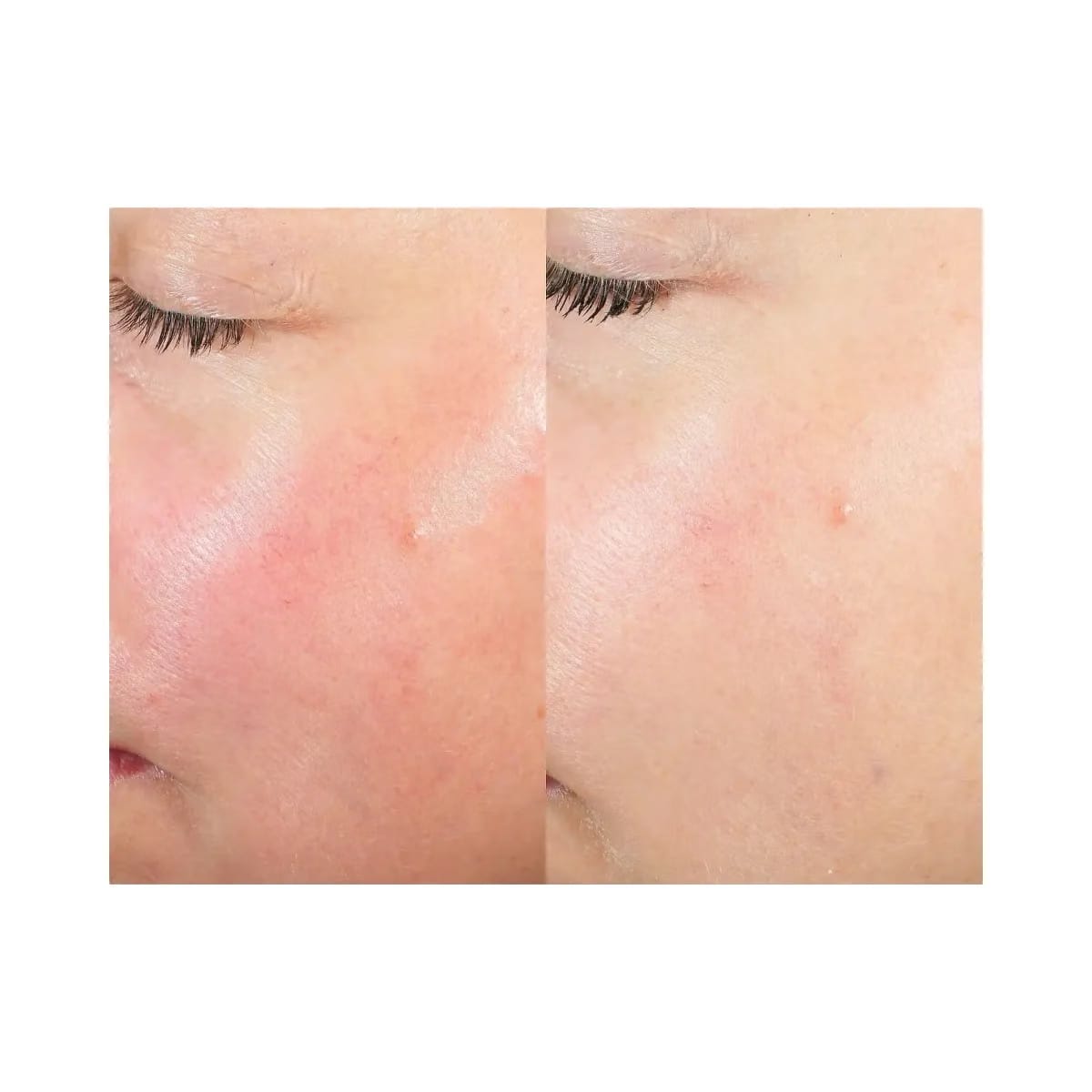 Summer Fridays Midnight Ritual Retinol Renewal Serum