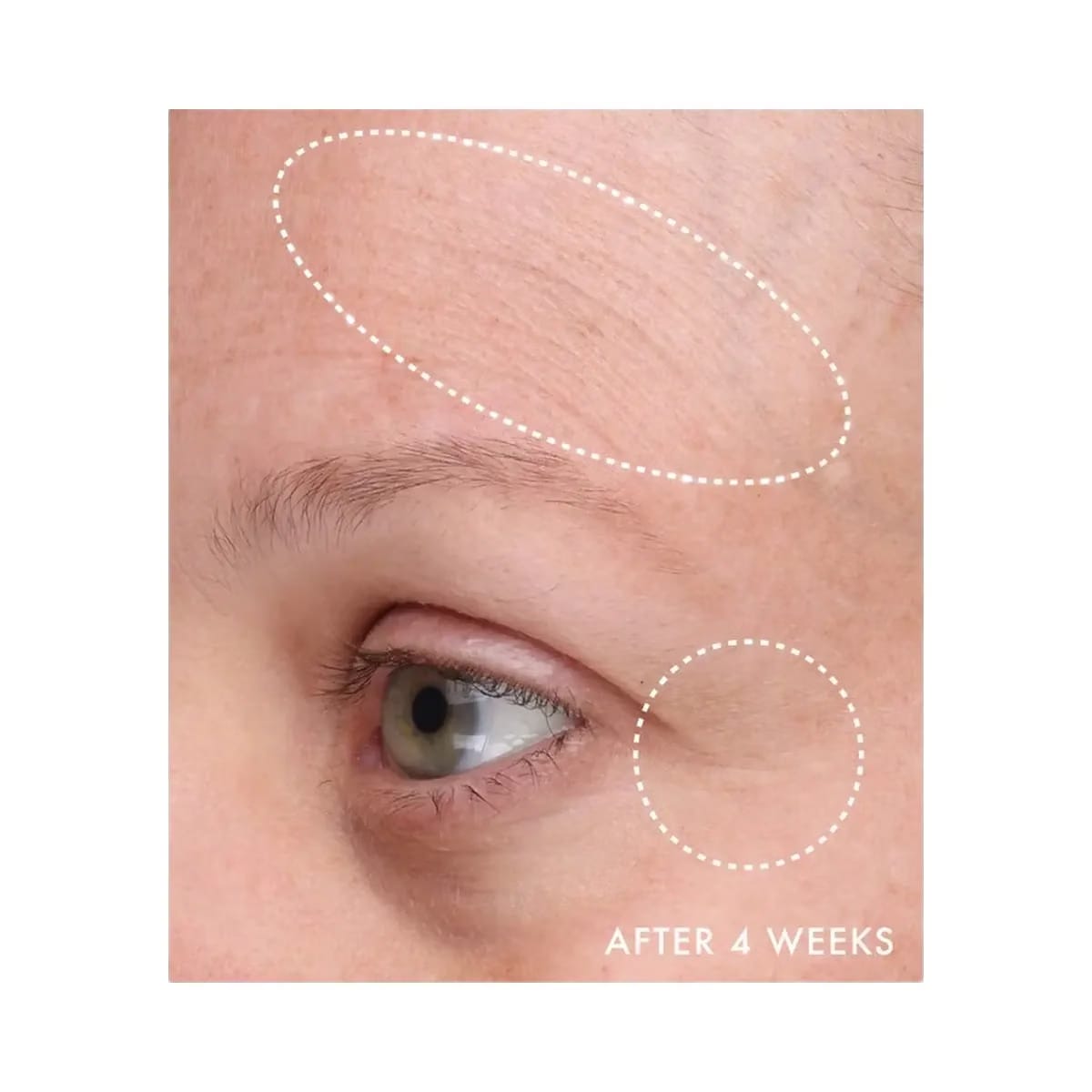 Summer Fridays Gentle Reset Daily Exfoliating Pads to Smooth + Minimize Pores with AHAs