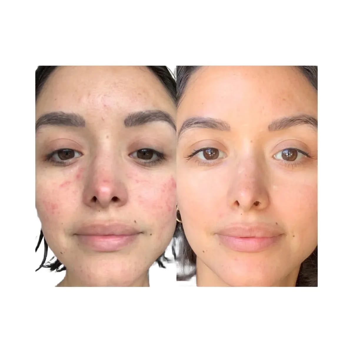 Summer Fridays CC Me Vitamin C + Niacinamide Serum