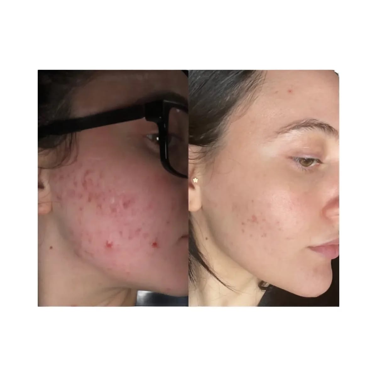 Summer Fridays CC Me Vitamin C + Niacinamide Serum