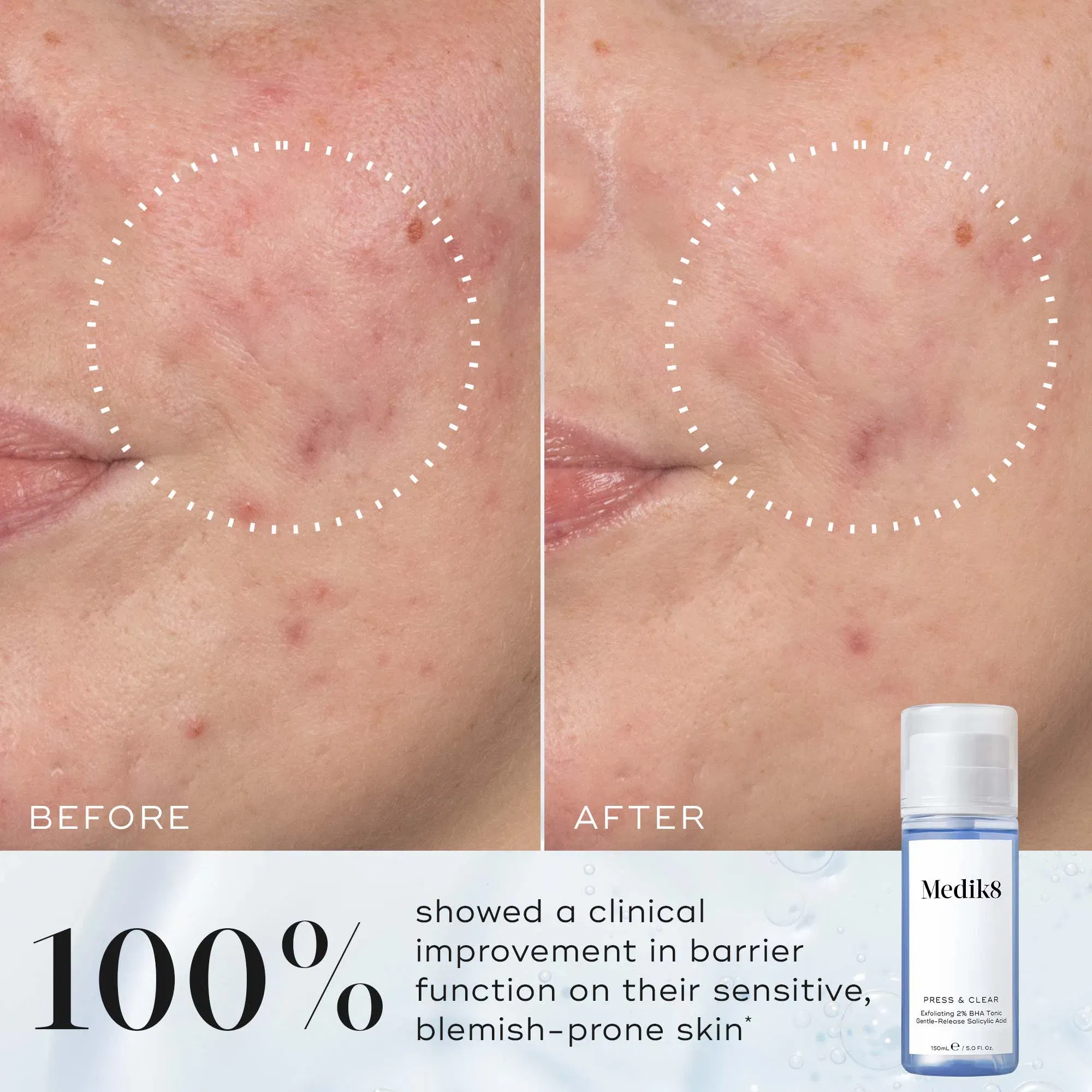 Medik8 Press & Clear Refill