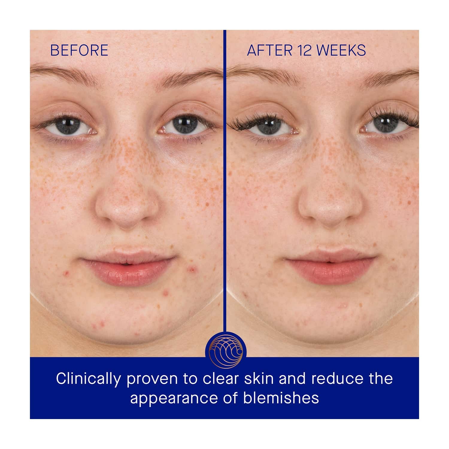 Augustinus Bader The Retinol Serum (50 ml) - Augustinus Bader