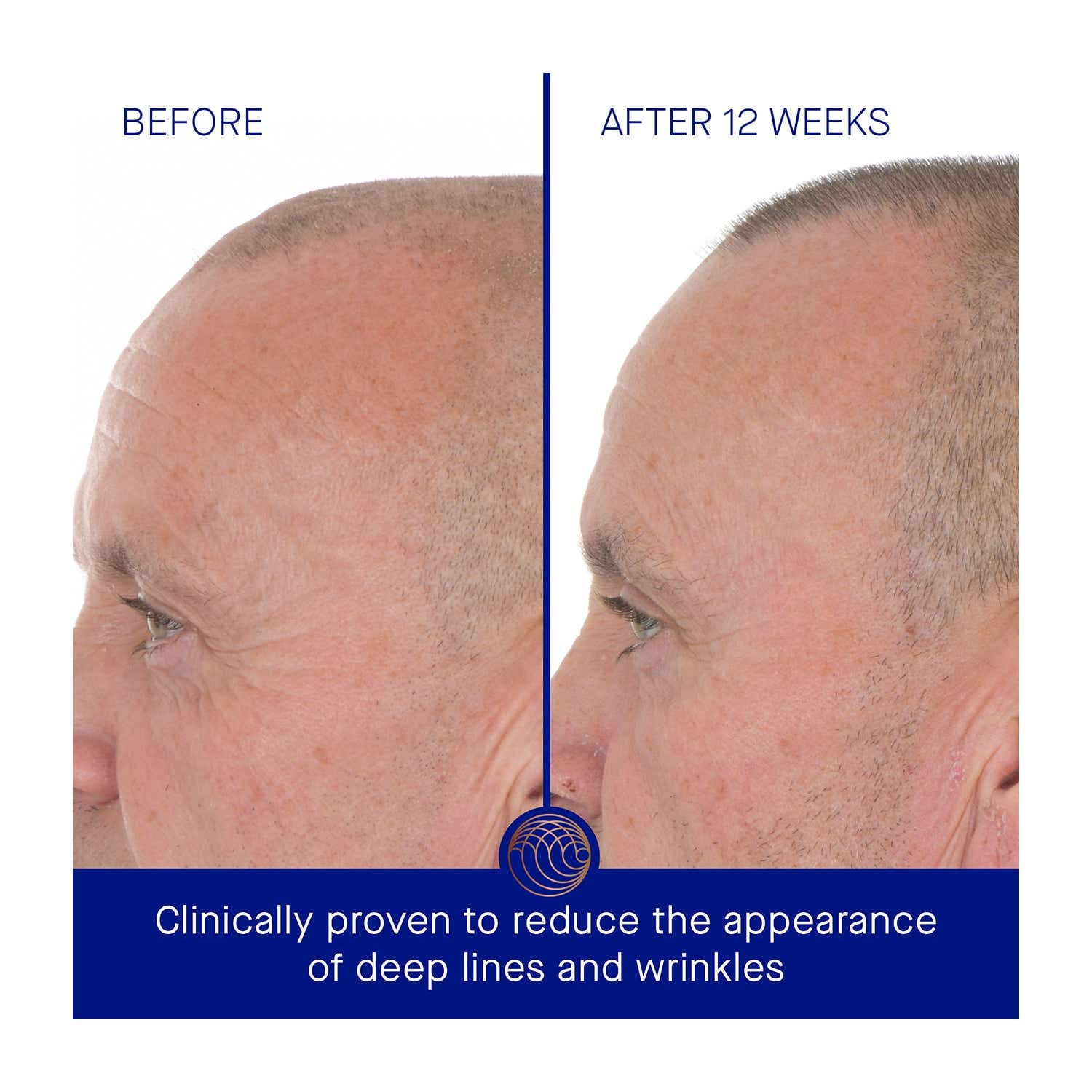 Augustinus Bader The Retinol Serum (50 ml) - Augustinus Bader