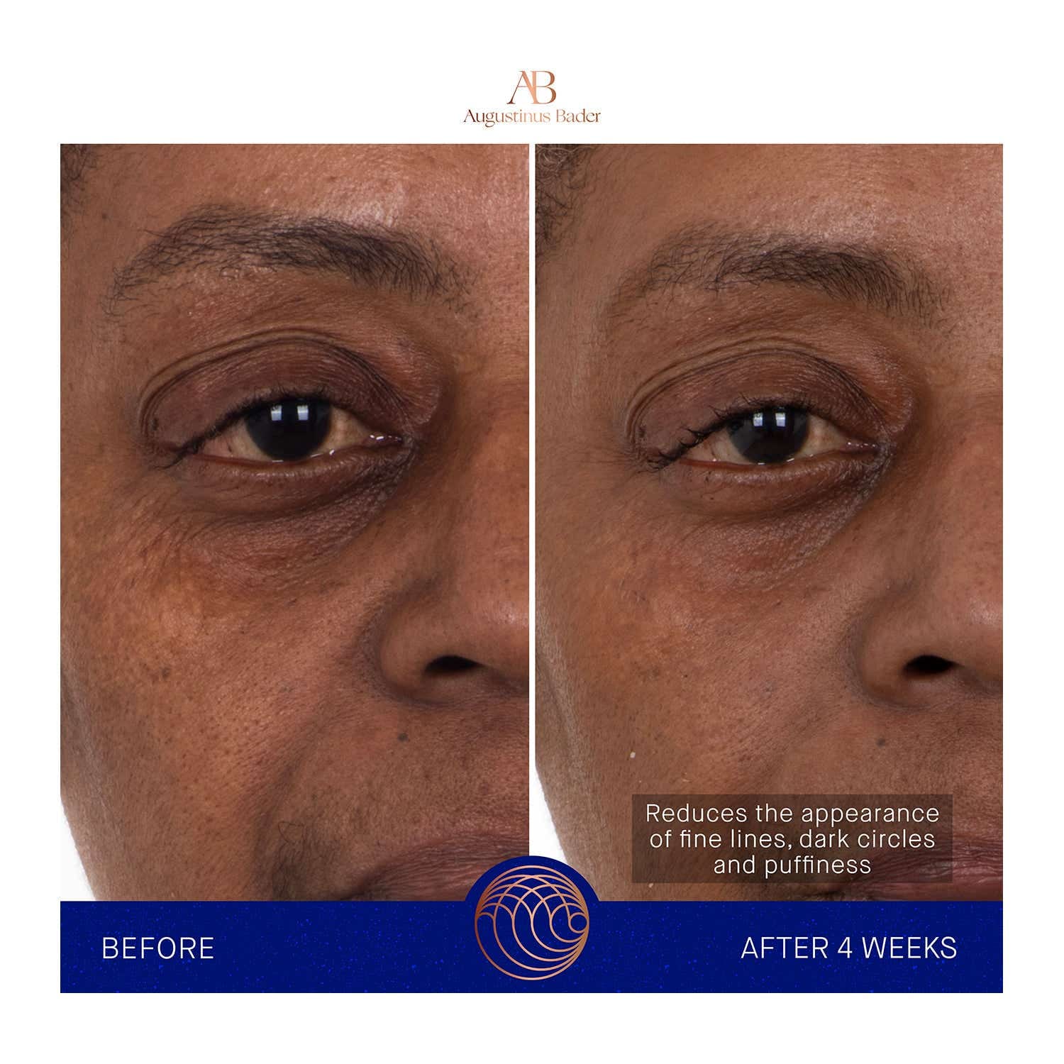 Augustinus Bader The Eye Patches (Pack of 6) - Augustinus Bader
