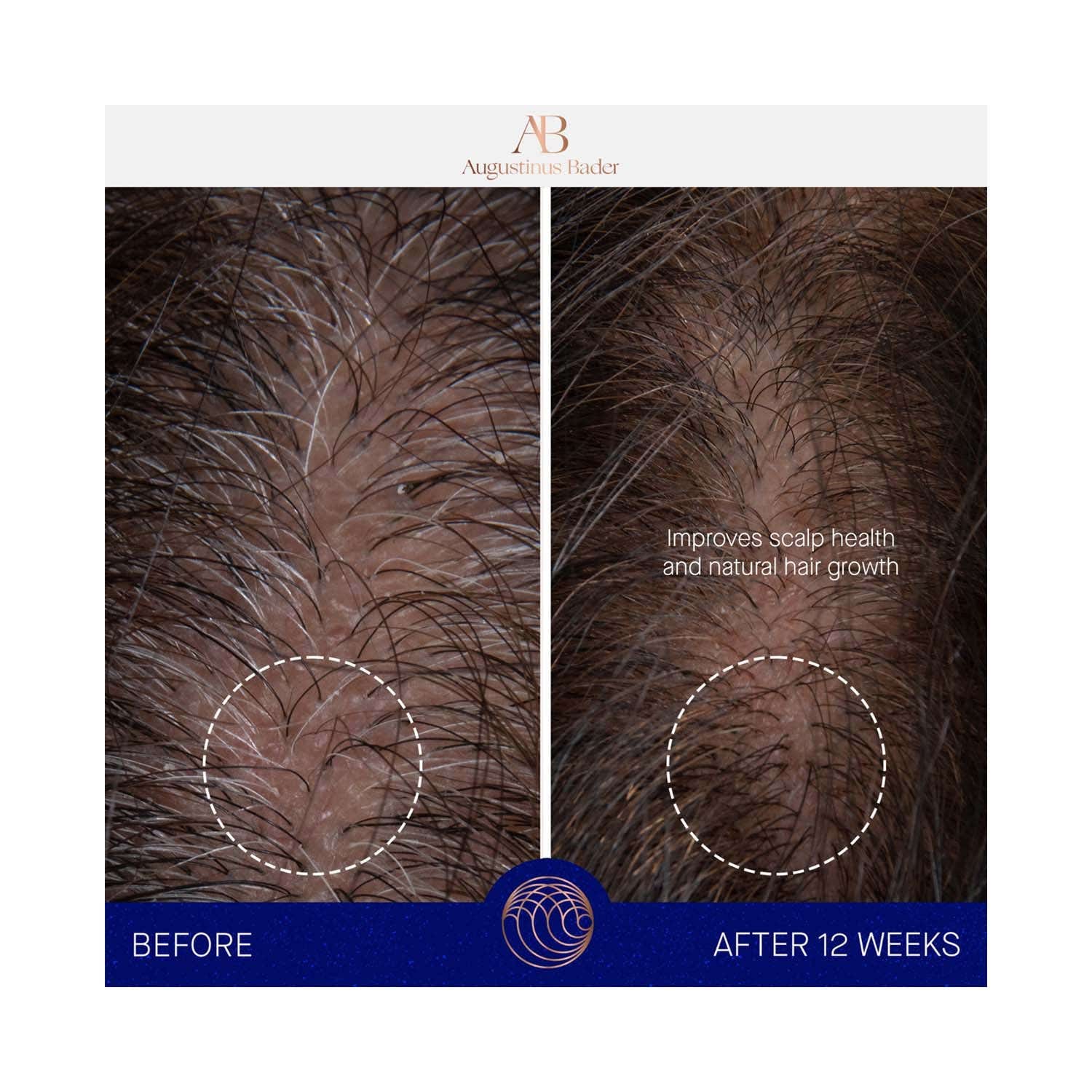 Augustinus Bader The Scalp Treatment (30 ml) - Augustinus Bader