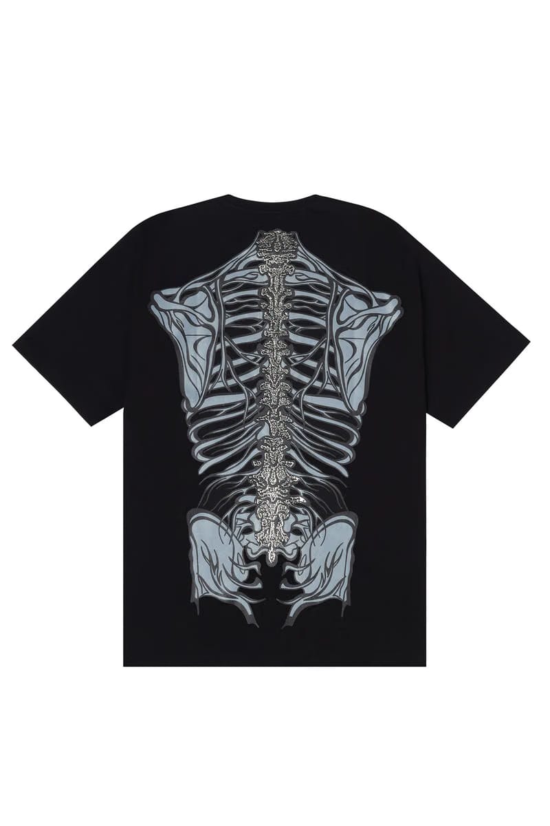 X- RAY T-SHIRT