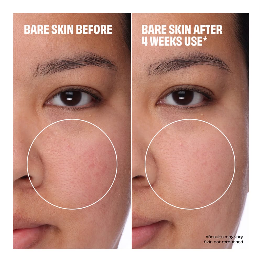 The Porefessional Foundation