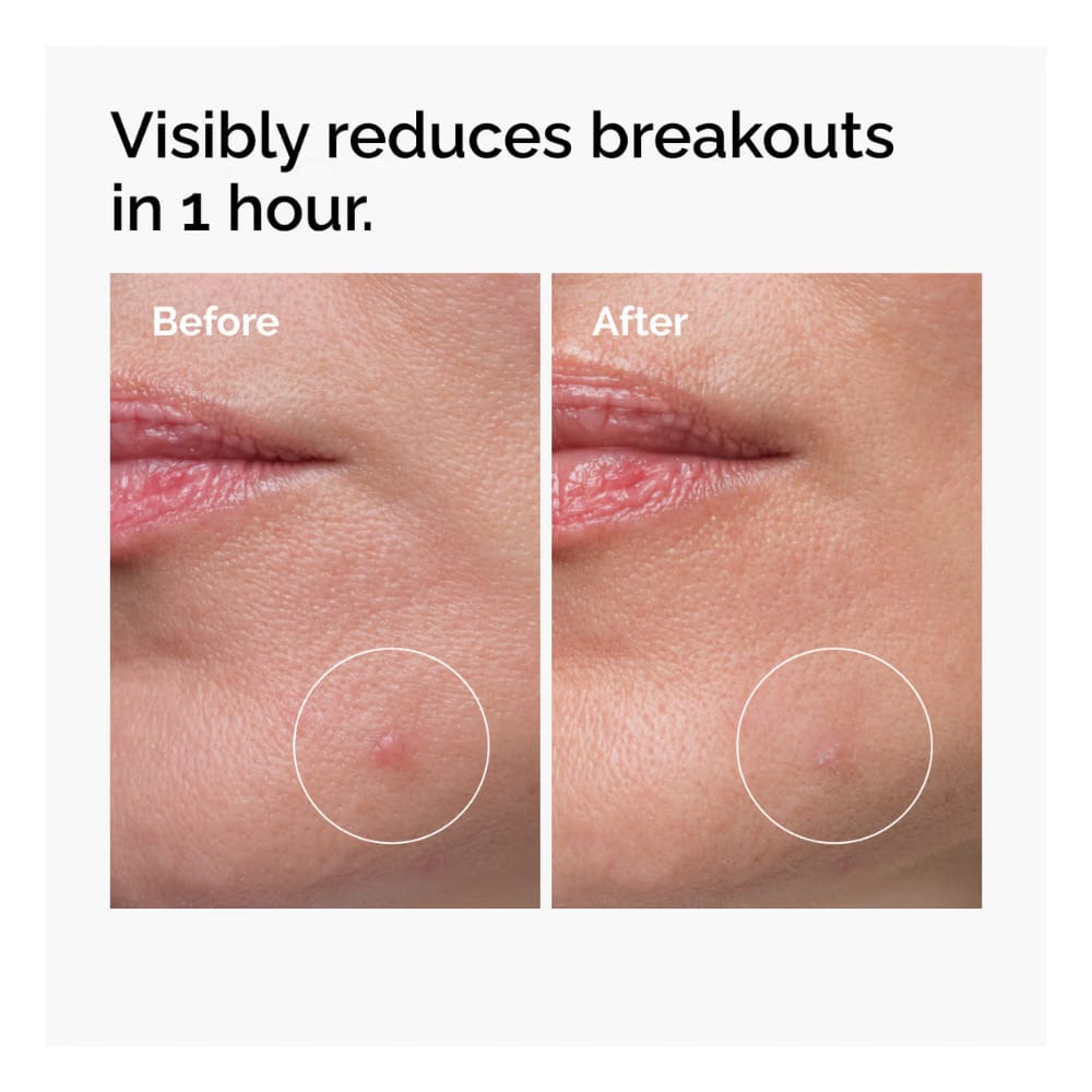 Sulfur 10% Powder-To-Cream Concentrate