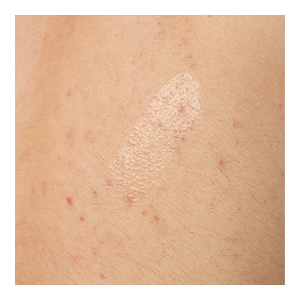 Salicylic Acid 0.5% Body Serum