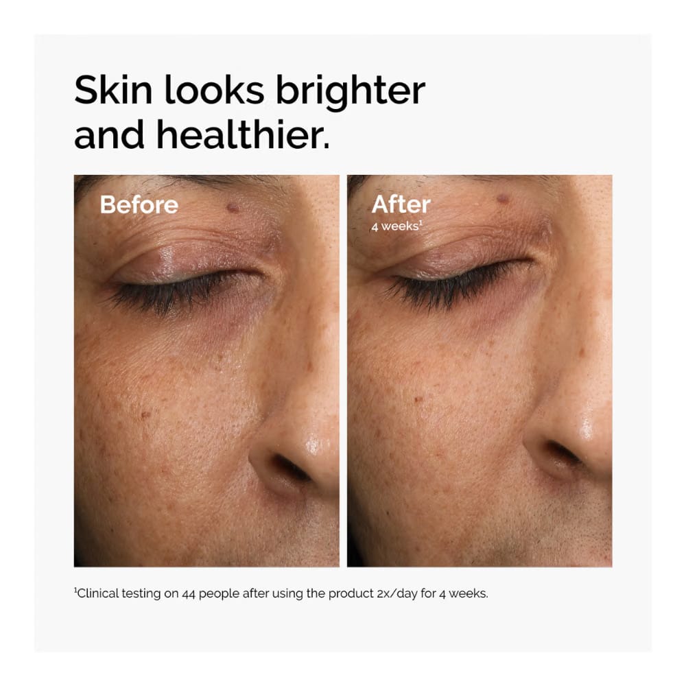 Multi-Antixoidant Radiance Serum