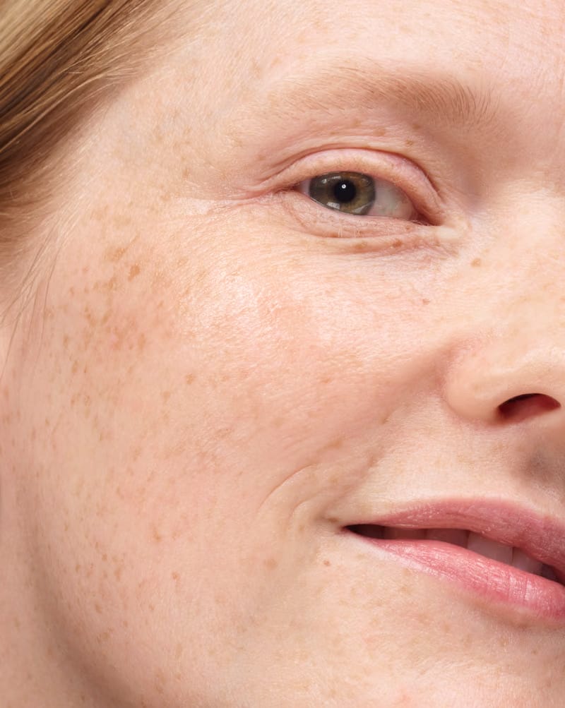 Universal Pro-Retinol