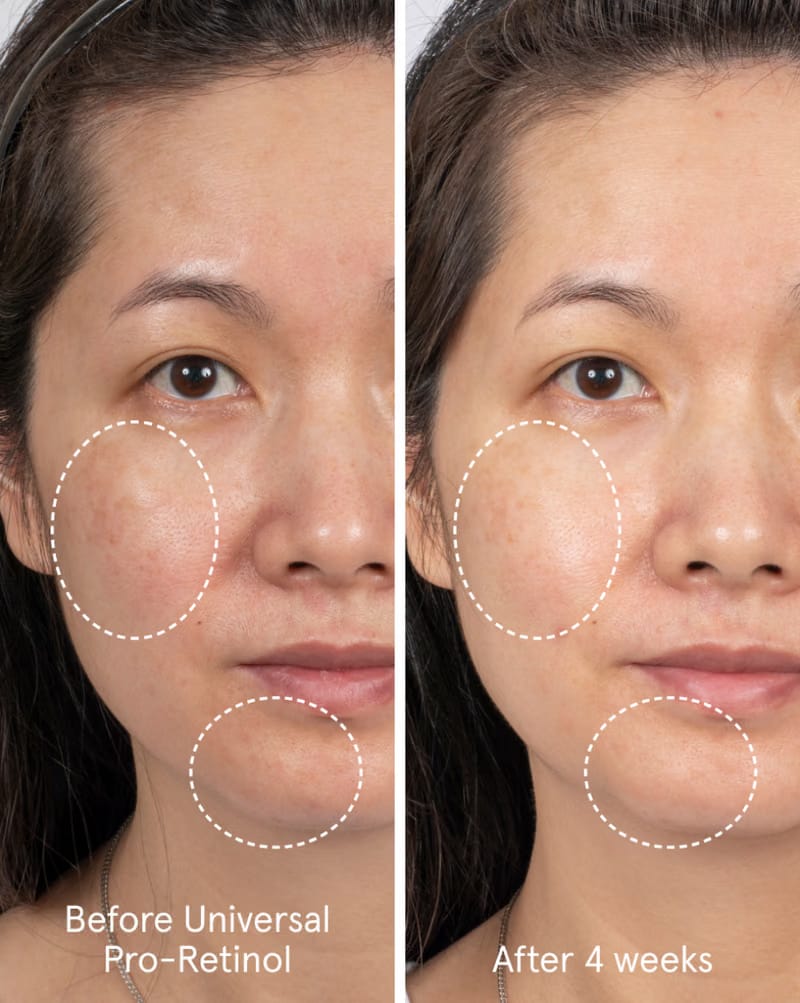Universal Pro-Retinol