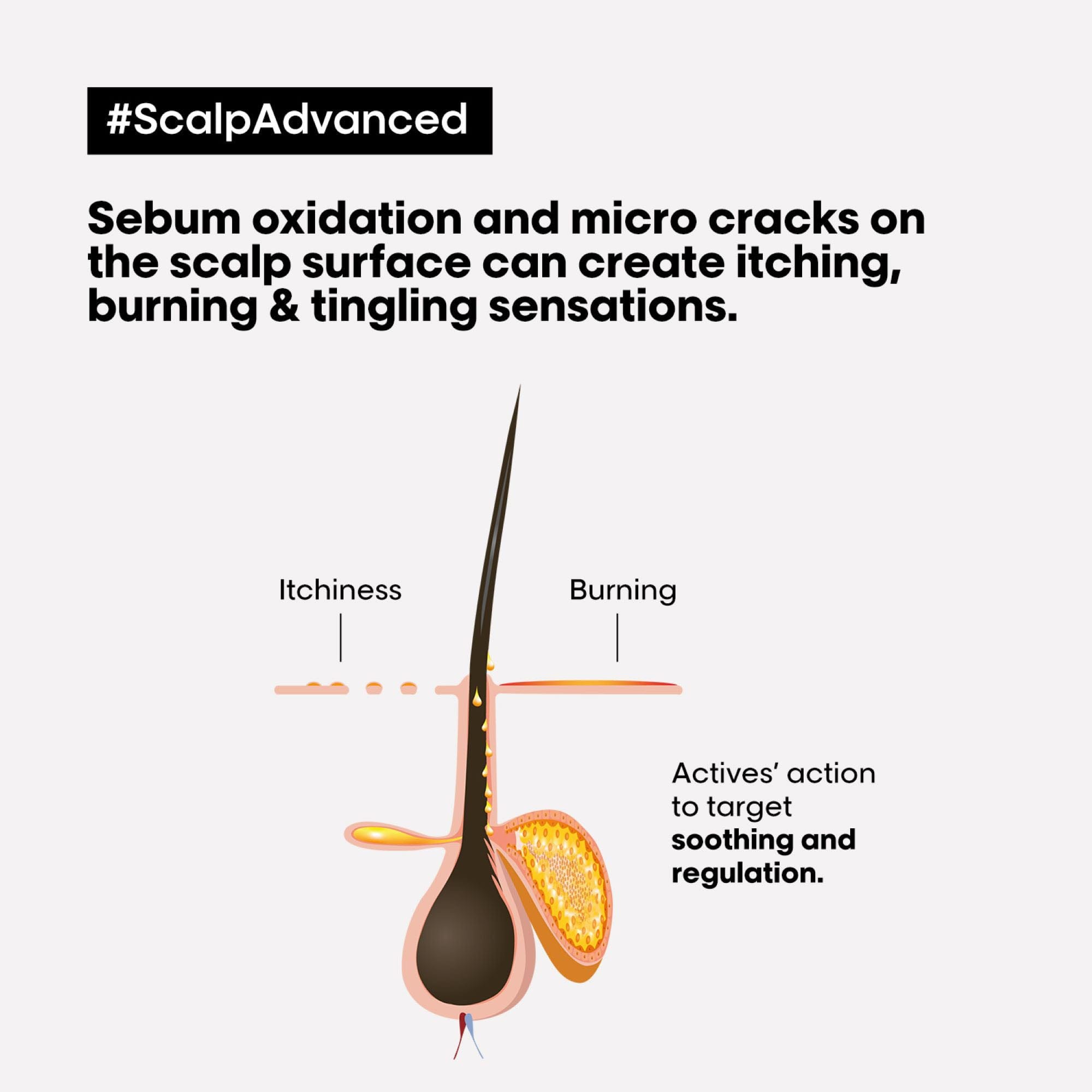L'Oréal Professionnel SERIE EXPERT Scalp Advanced Anti-Discomfort Dermo-Regulator Shampoo 300ml