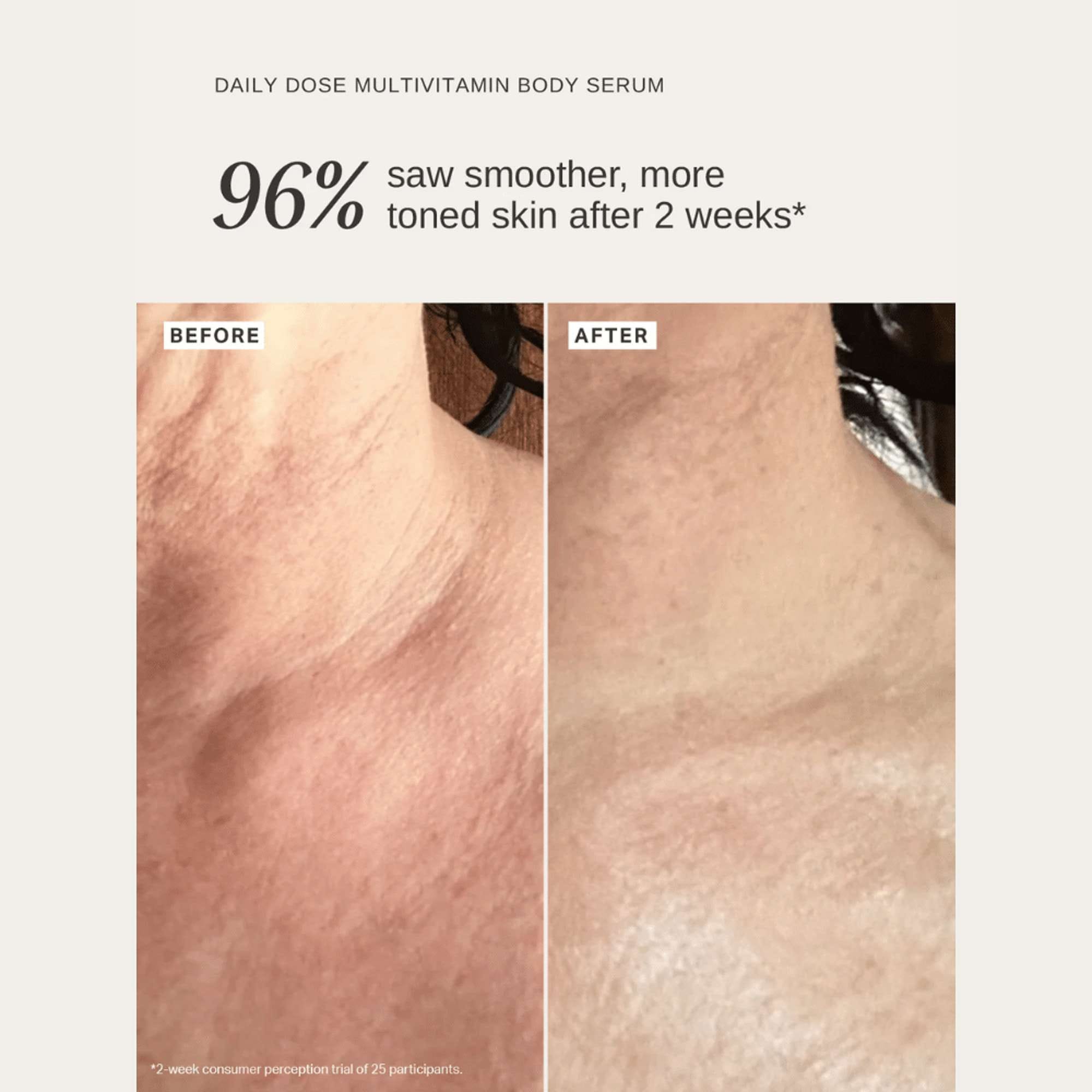 Alpha H Serums Daily Dose Multivitamin Body Serum with Niacinamide, Vitamin C + Hyaluronic Acid 150ml