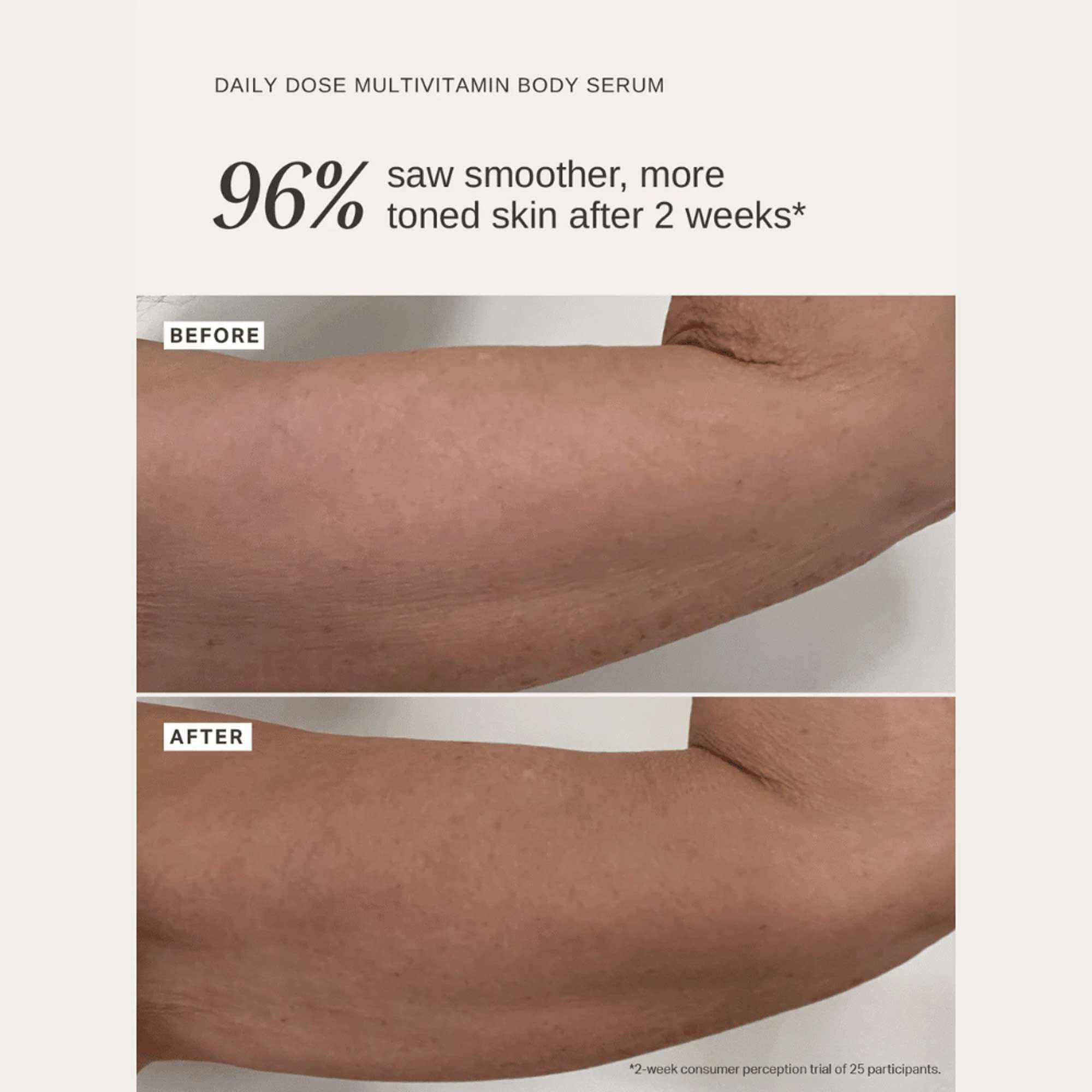 Alpha H Serums Daily Dose Multivitamin Body Serum with Niacinamide, Vitamin C + Hyaluronic Acid 150ml