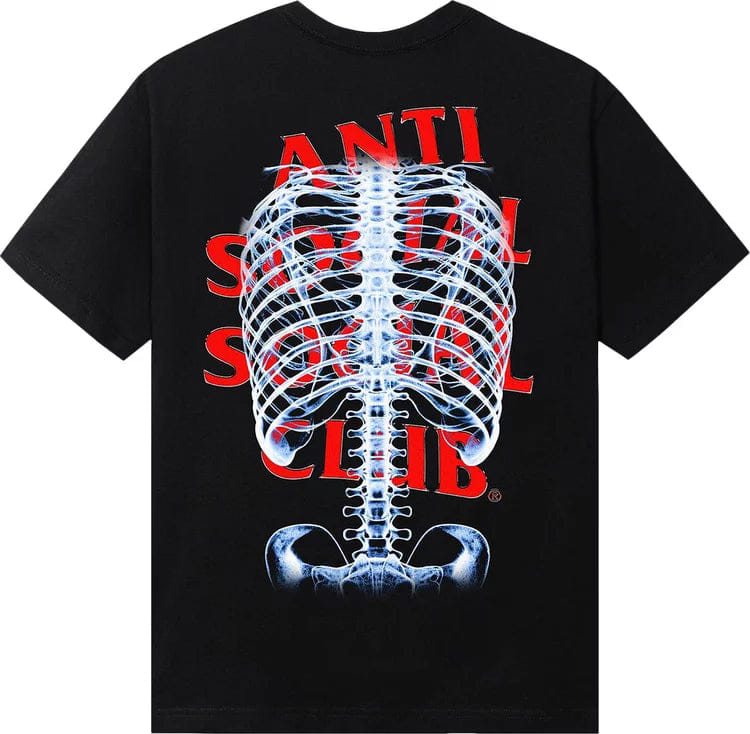 Anti Social Social Club Bones T-Shirt Black