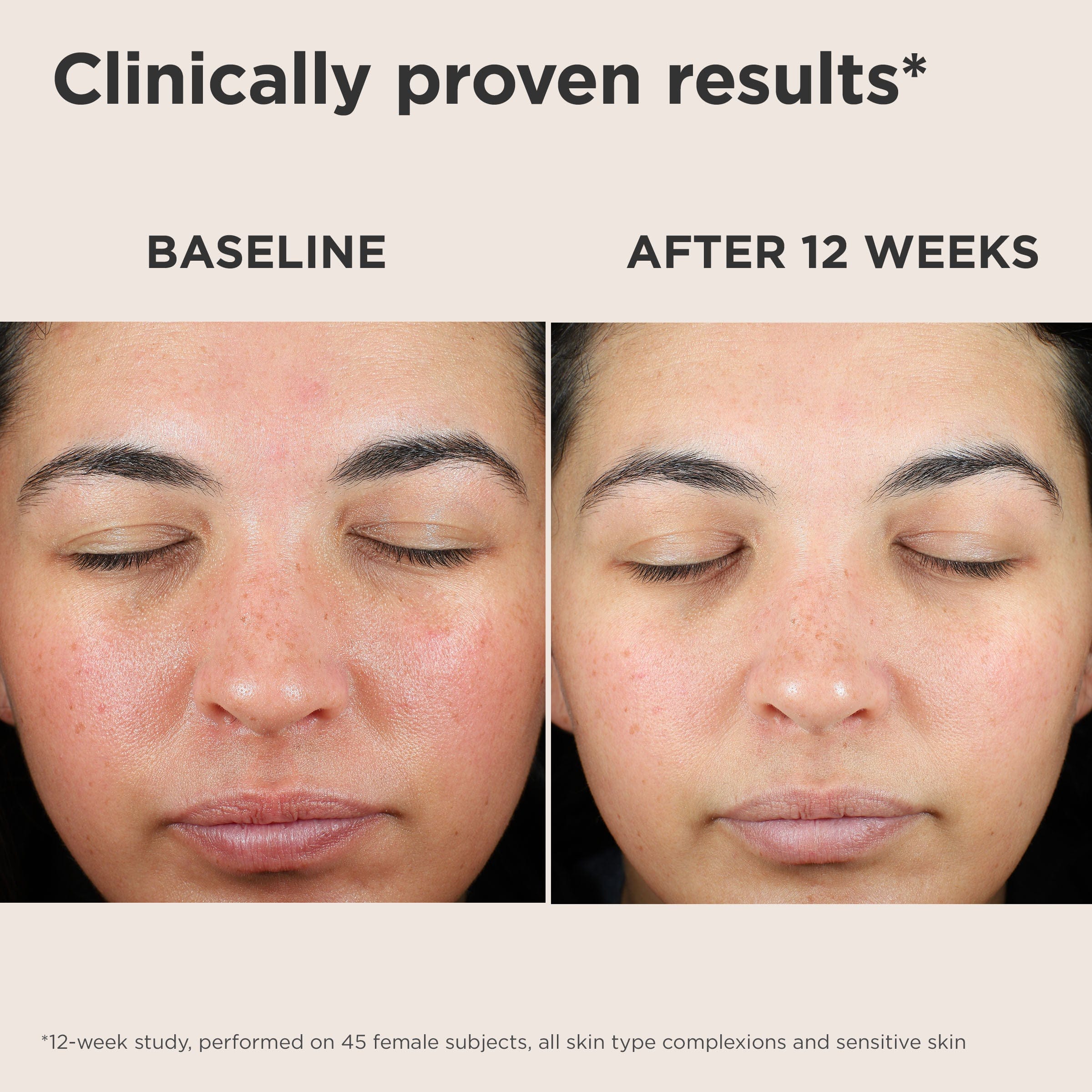 Eltamd UV Skin Recovery Broad Spectrum SPF 50