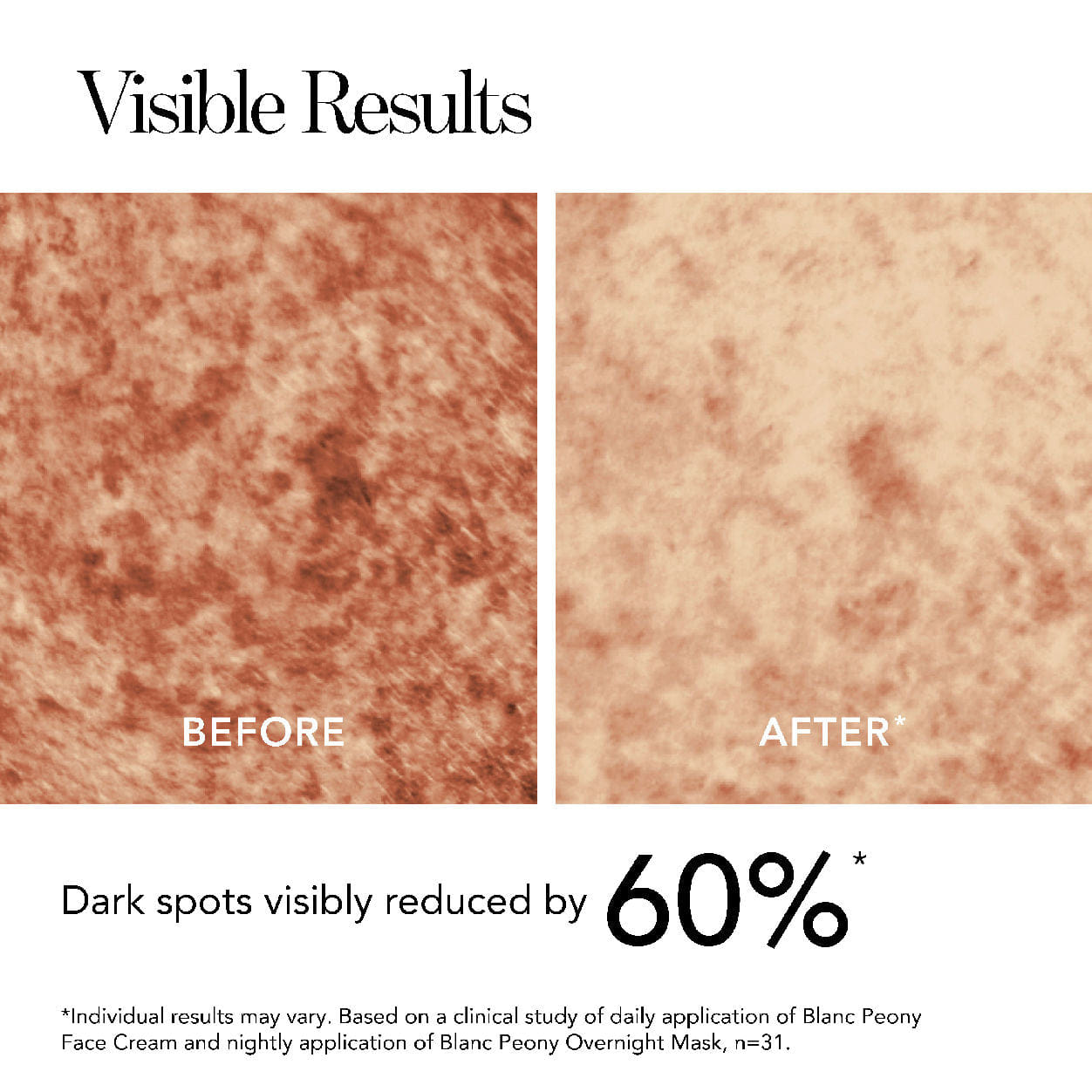 Chantecaille Blanc Peony Brightening Overnight Mask for Dark Spots