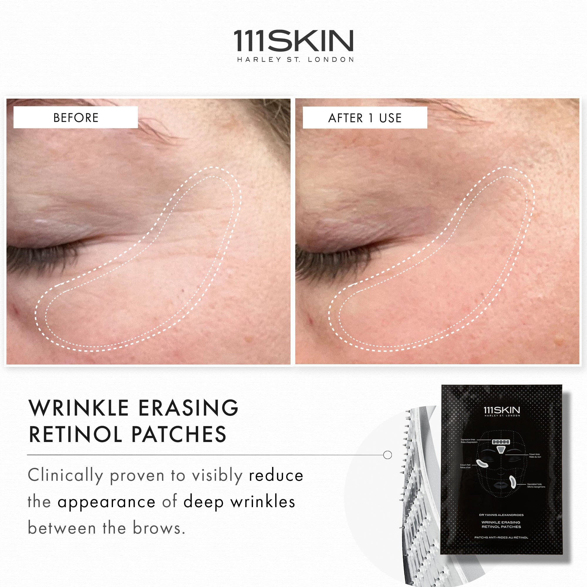 111skin Wrinkle Erasing Retinol Patches