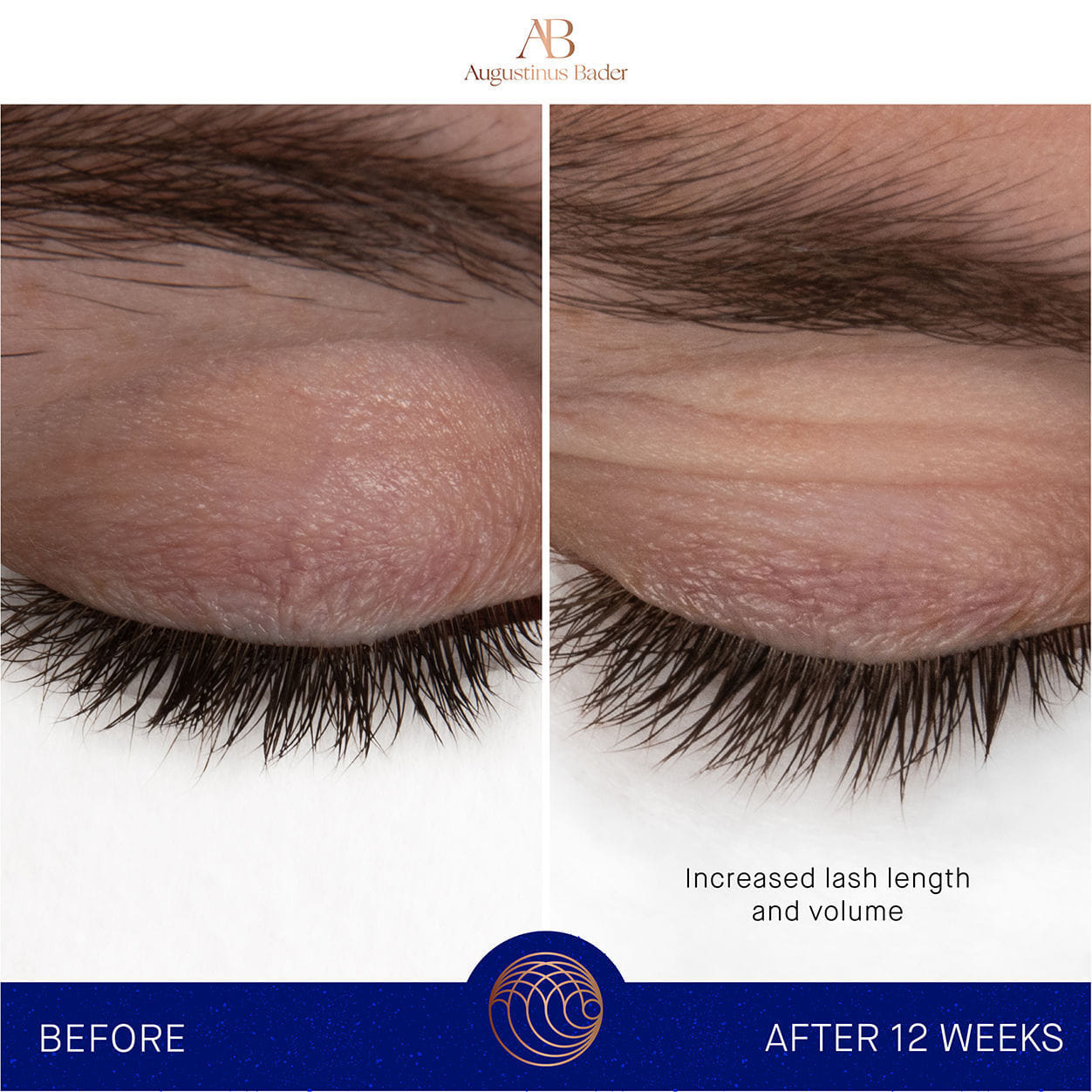 Augustinus Bader The Eyebrow and Lash Enhancing Serum