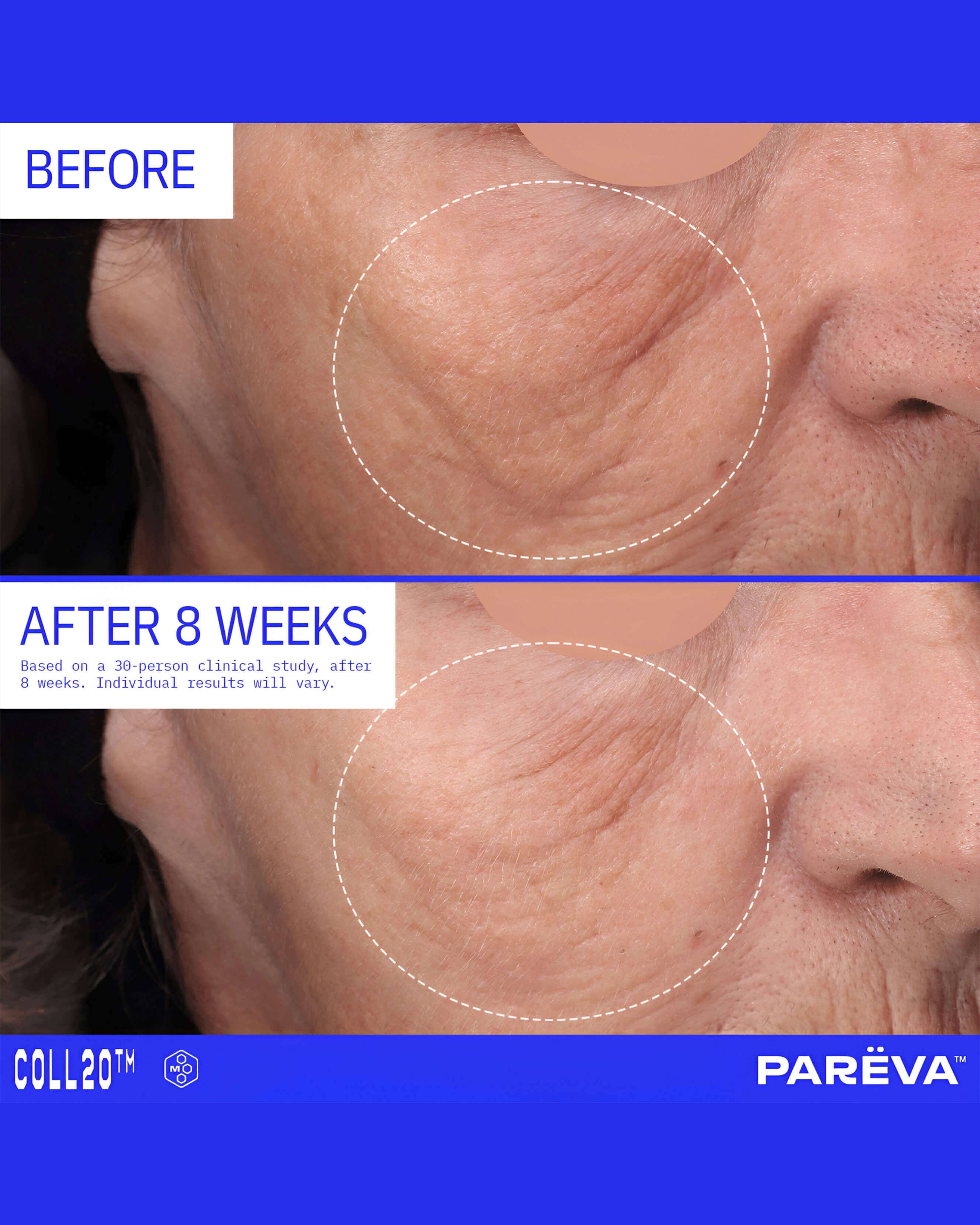 Parëva Beauty Coll20 Gel Cream Moisturizer