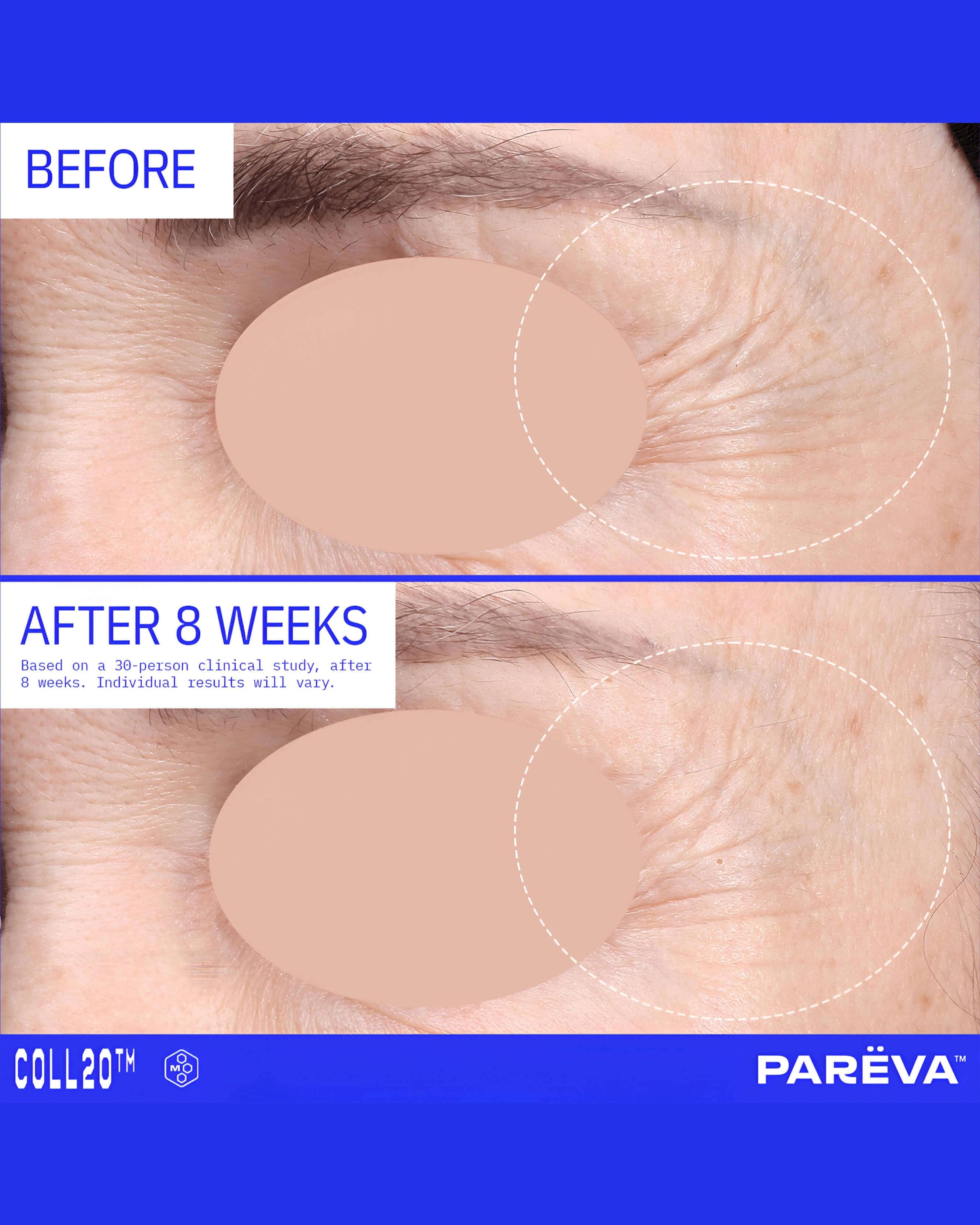 Parëva Beauty Coll20 Gel Cream Moisturizer