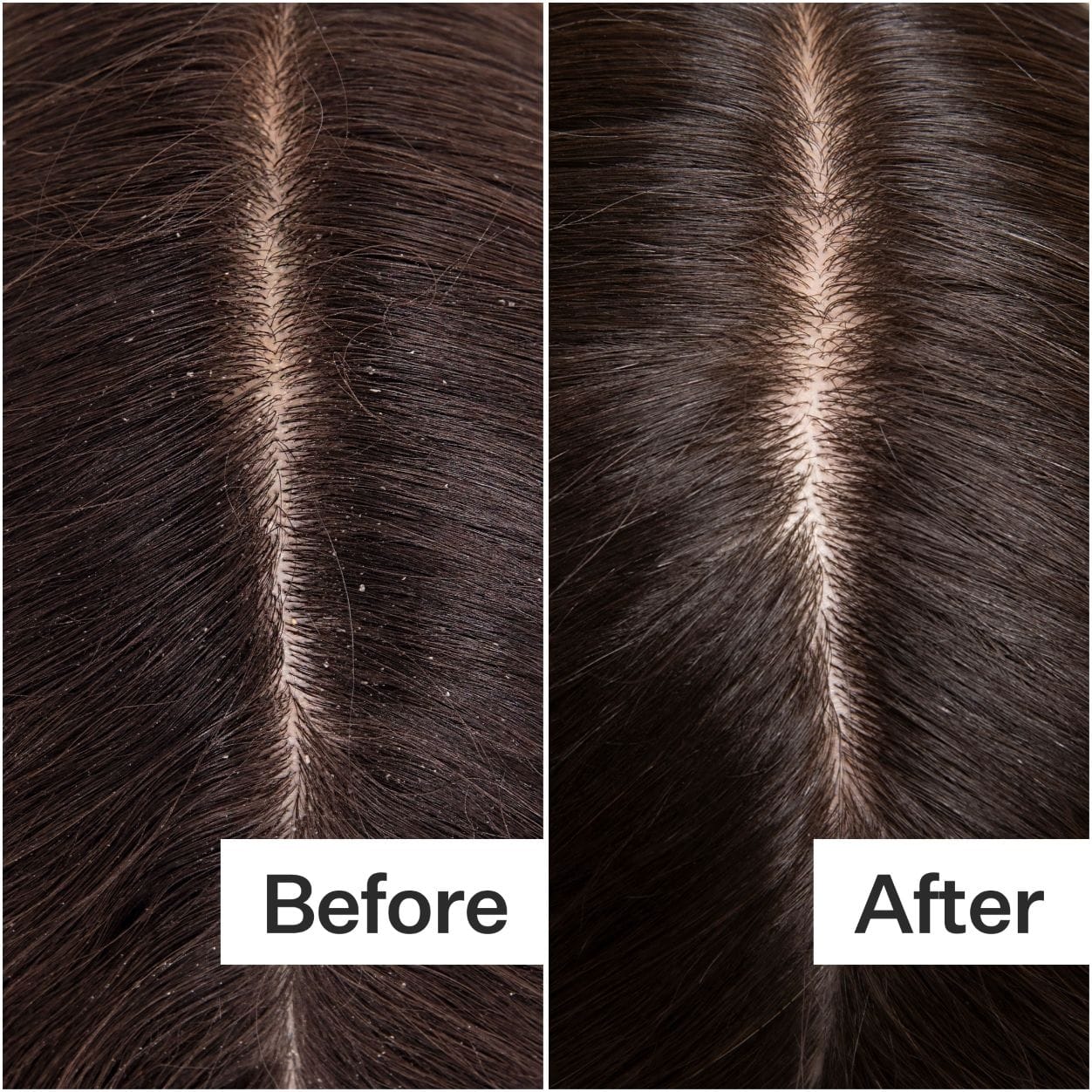 Act+acre Cold Processed Hair Cleanse Shampoo